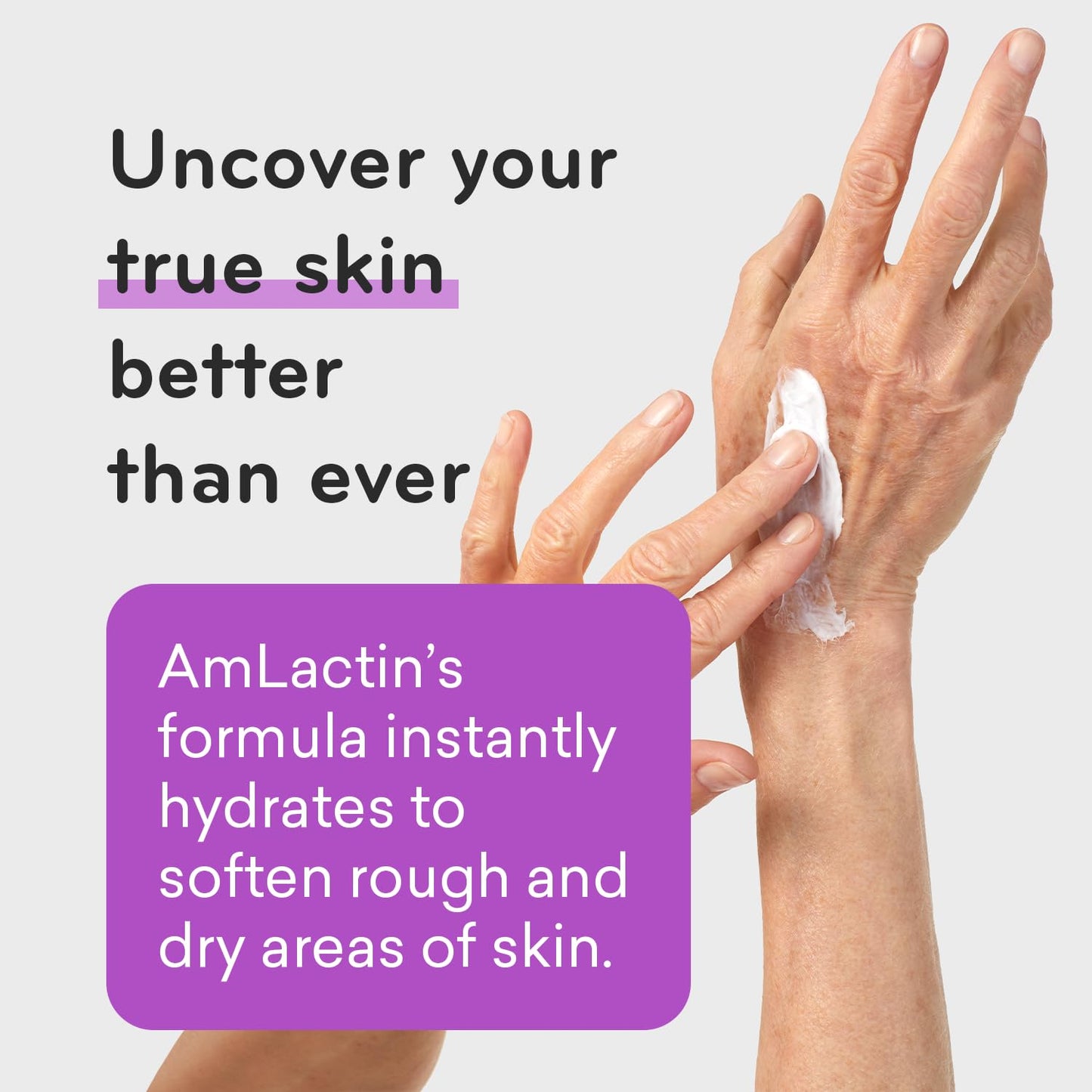 AmLactin Ultra Smoothing Cream 4.9 oz – 15% Lactic Acid Exfoliating & Moisturizing Lotion for Rough, Dry, Bumpy Skin (Packaging May Vary)