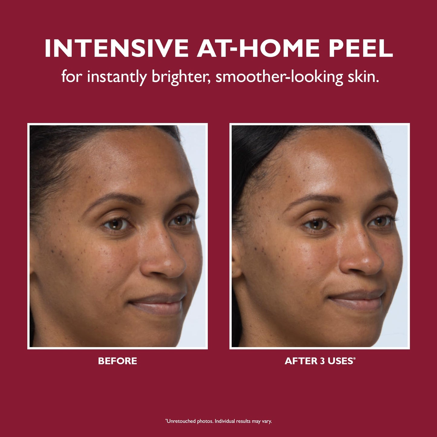 Peter Thomas Roth | Even Smoother™ Instant Reveal Facial Peel