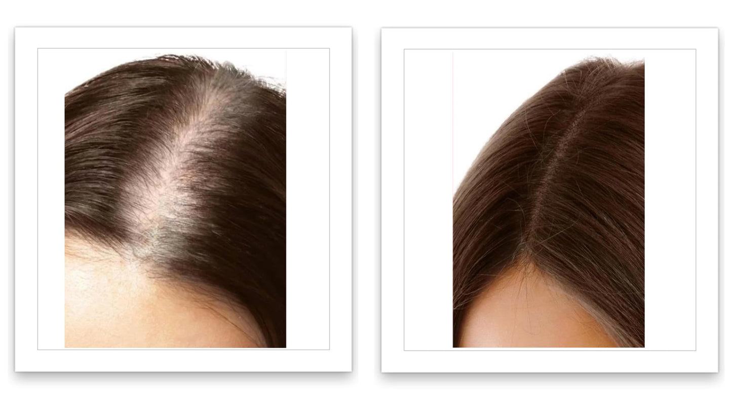 Caboki 10X Volumizing Hair Powder Dark Brown – Covers Bald Spots & Grays, Fills Hairline & Edges, Root Touch-Up for Thinning Hair, Talc-Free''[;[/