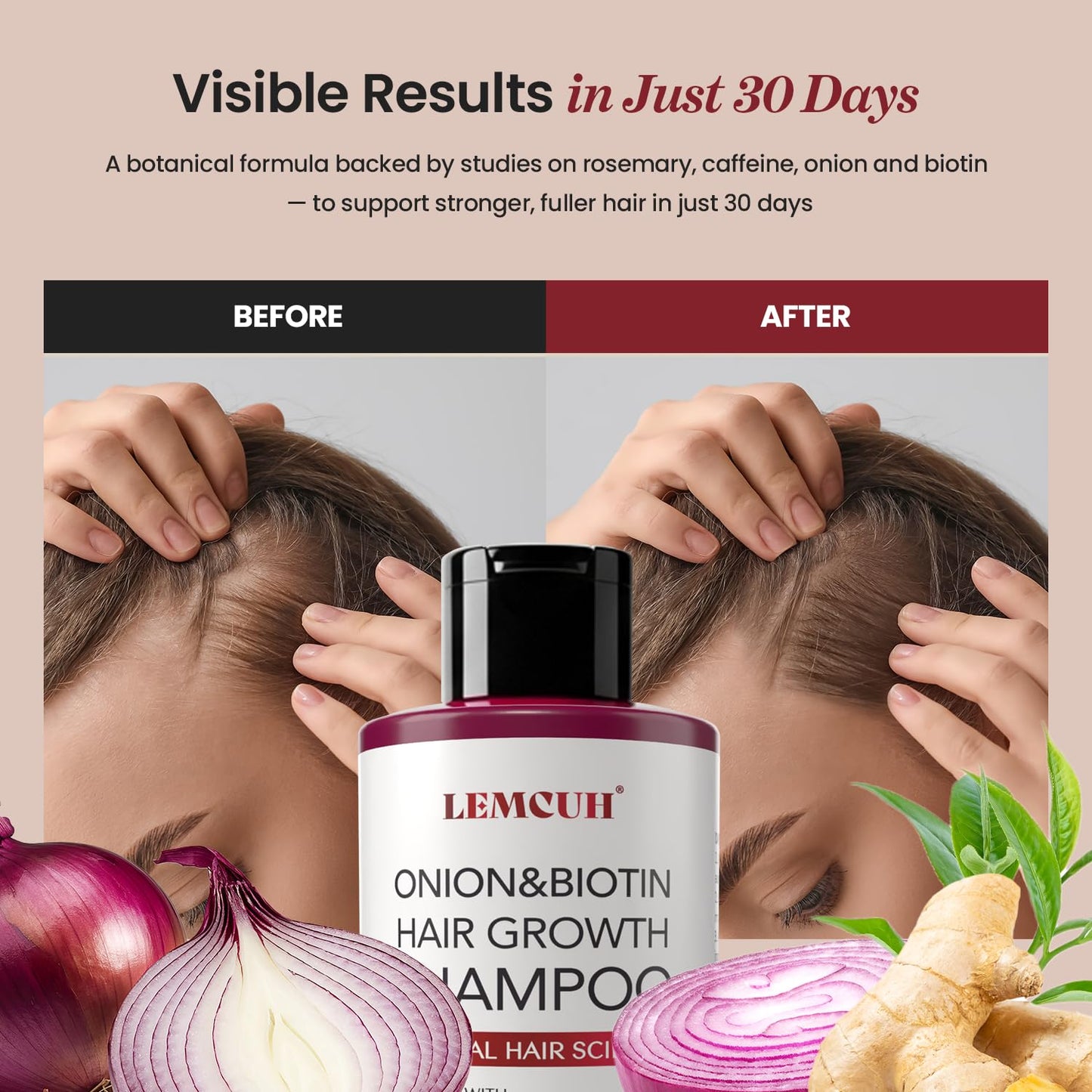 Onion & Biotin Hair Growth Shampoo with Rosemary & Tea Tree Oil – Anti Hair Loss & Thickening Formula for Strong, Healthy Hair (12.5 Fl Oz)