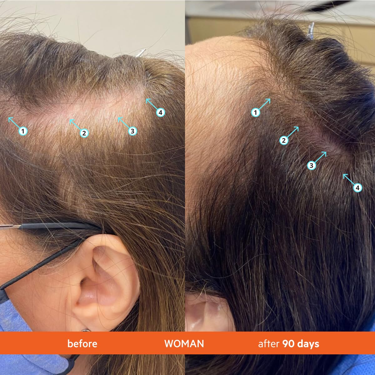 DS Labs Revita Shampoo 205mL – Boosts Thickness & Volume, Deep Scalp Cleanse, Lightweight Hydration, Sulfate-Free, Color Safe, Unisex Formula