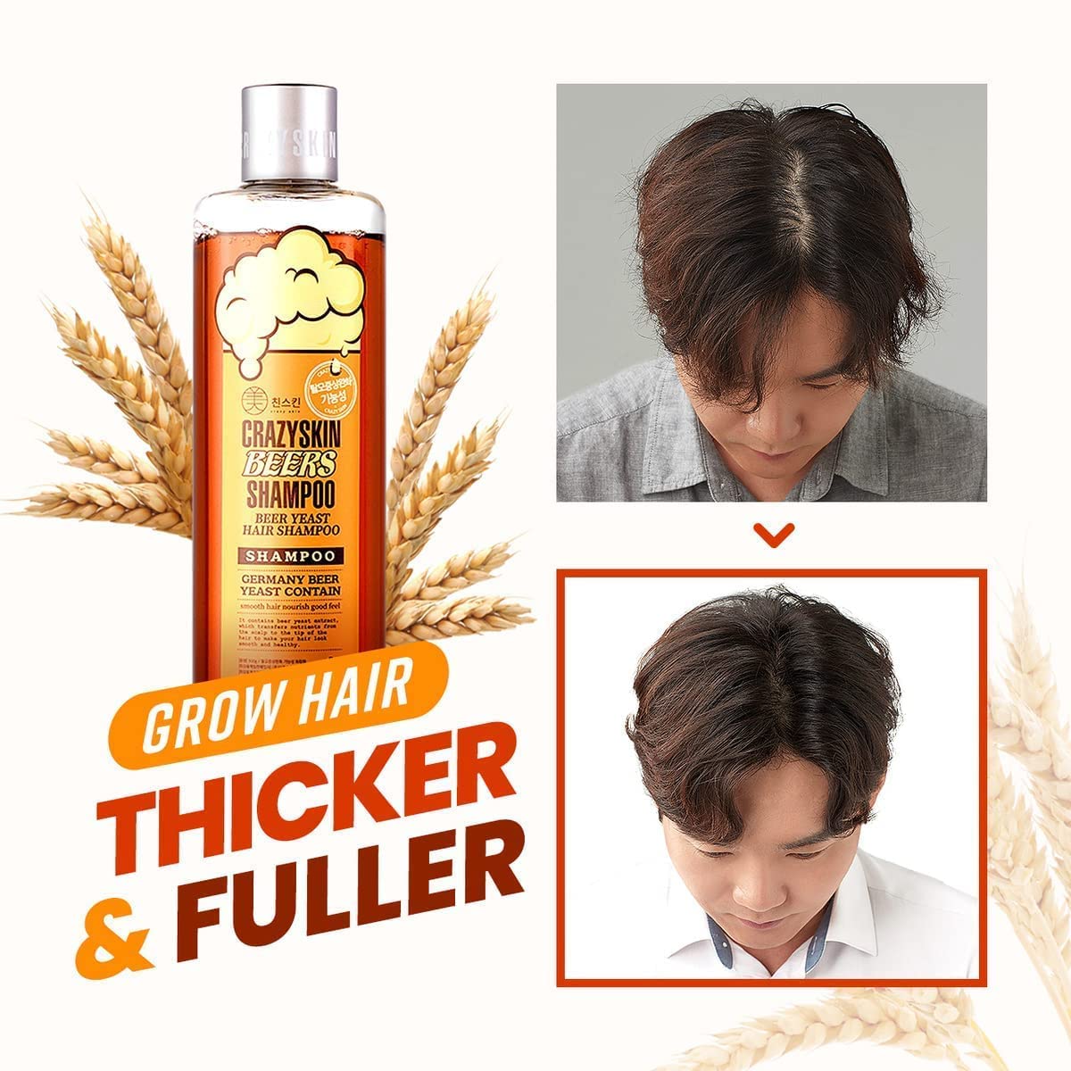 CRAZY SKIN German Beer Yeast Biotin Shampoo 300ml โ Anti-Hair Loss, Thickening, Hard Water Defense, Gentle Exfoliating, Sulfate-Free Formula