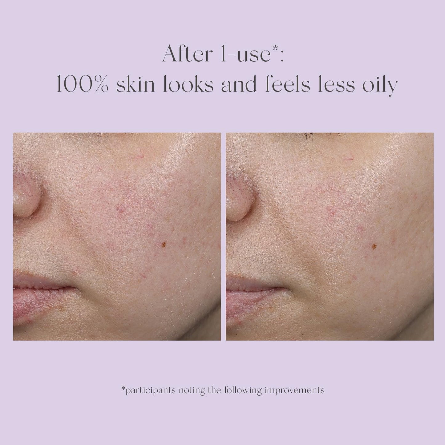 EXUVIANCE Performance Peel AP25 At-Home Chemical Peel with Glycolic, Mandelic and Polyhydroxy Acids, 13 ct.