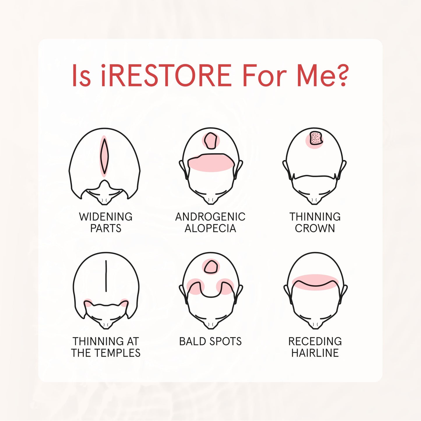 iRestore Anti Hair Loss and Thinning Shampoo - Biotin Formula for Hair Growth, Thickening and Volumizing for Men & Women