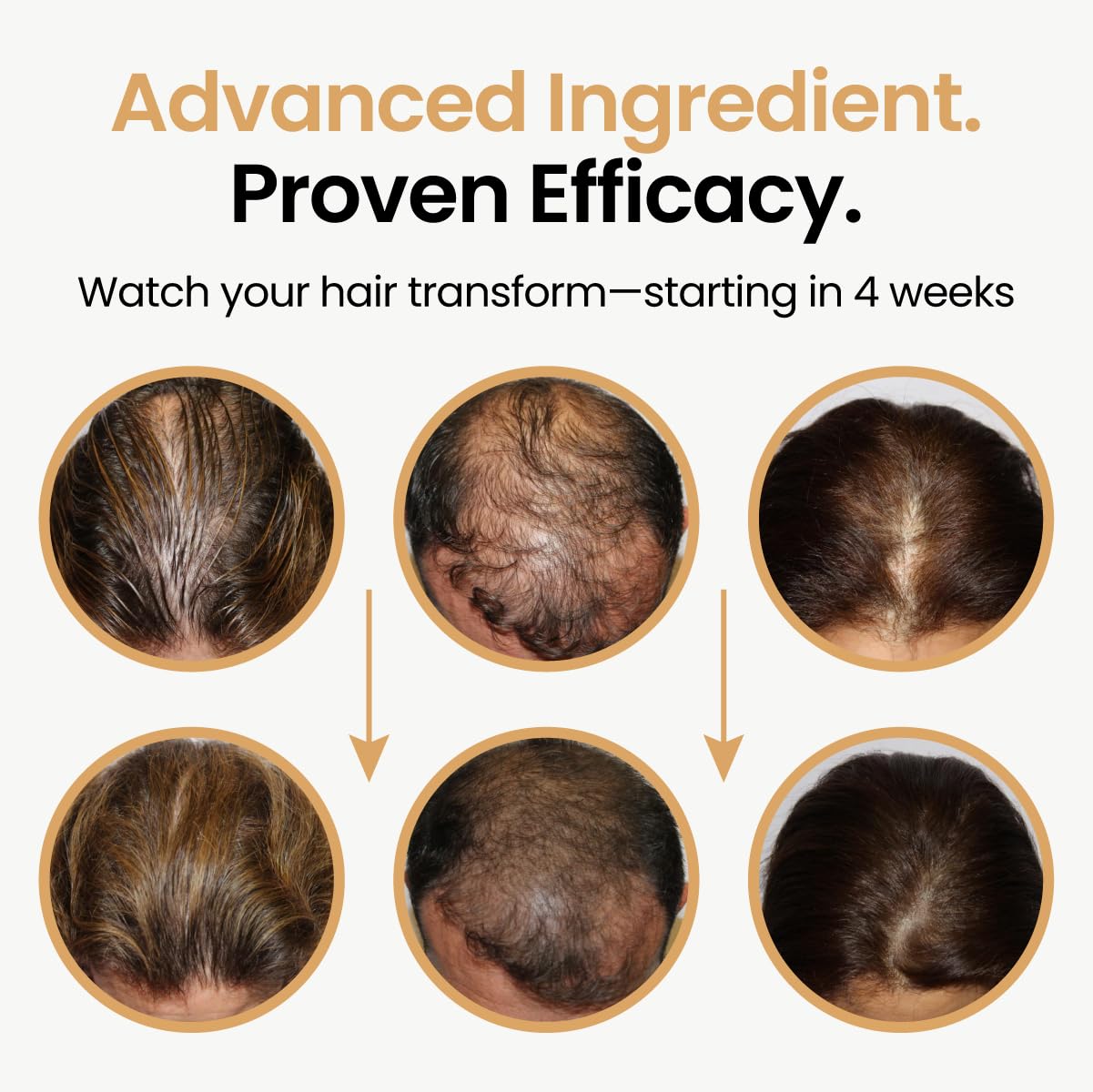 Hair Booster Serum for Women & Men – Peptide-Enriched Hair Tonic with Capilia Longa & Arginine for Thick, Strong, Revitalized Hair – 2 Fl Oz, 3 Pack