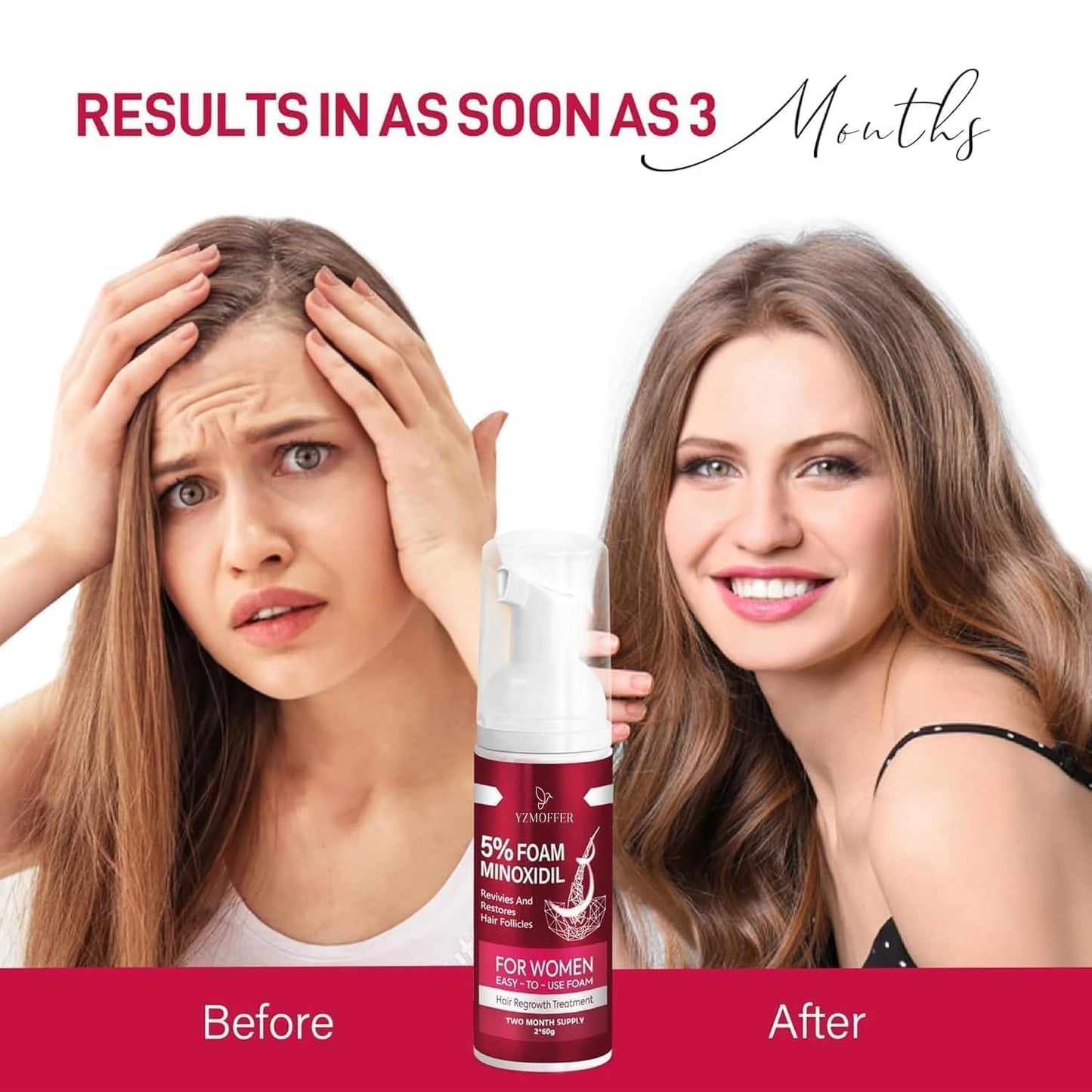 Yzmoffer 5% Minoxidil Foam for Women – Hair Regrowth Treatment to Reduce Thinning & Hair Loss, Nourish Scalp for Thicker, Fuller Hair, 2 x 60g