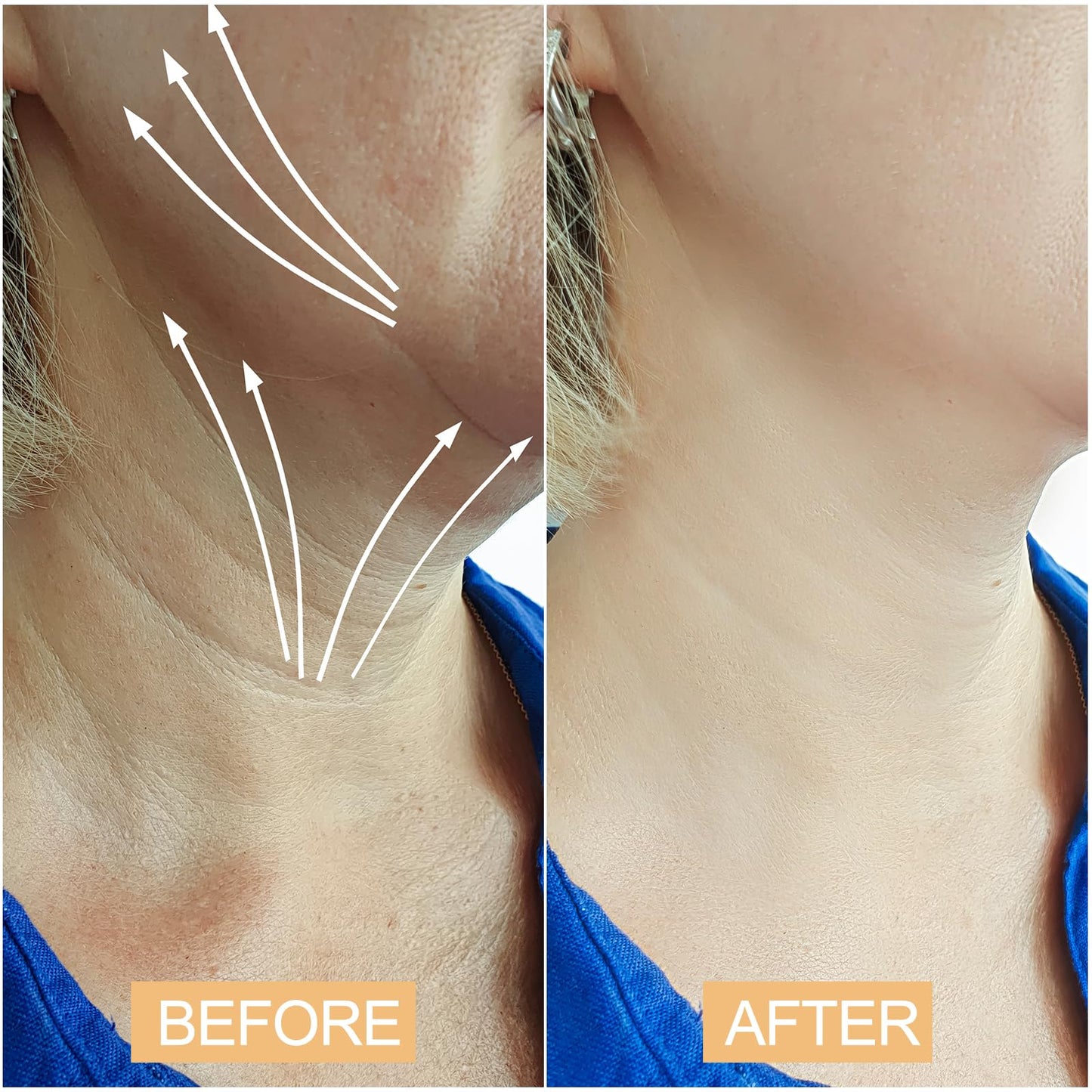 Neck Lift Tape Tightening Tape - Neck Tape Lifting Invisible