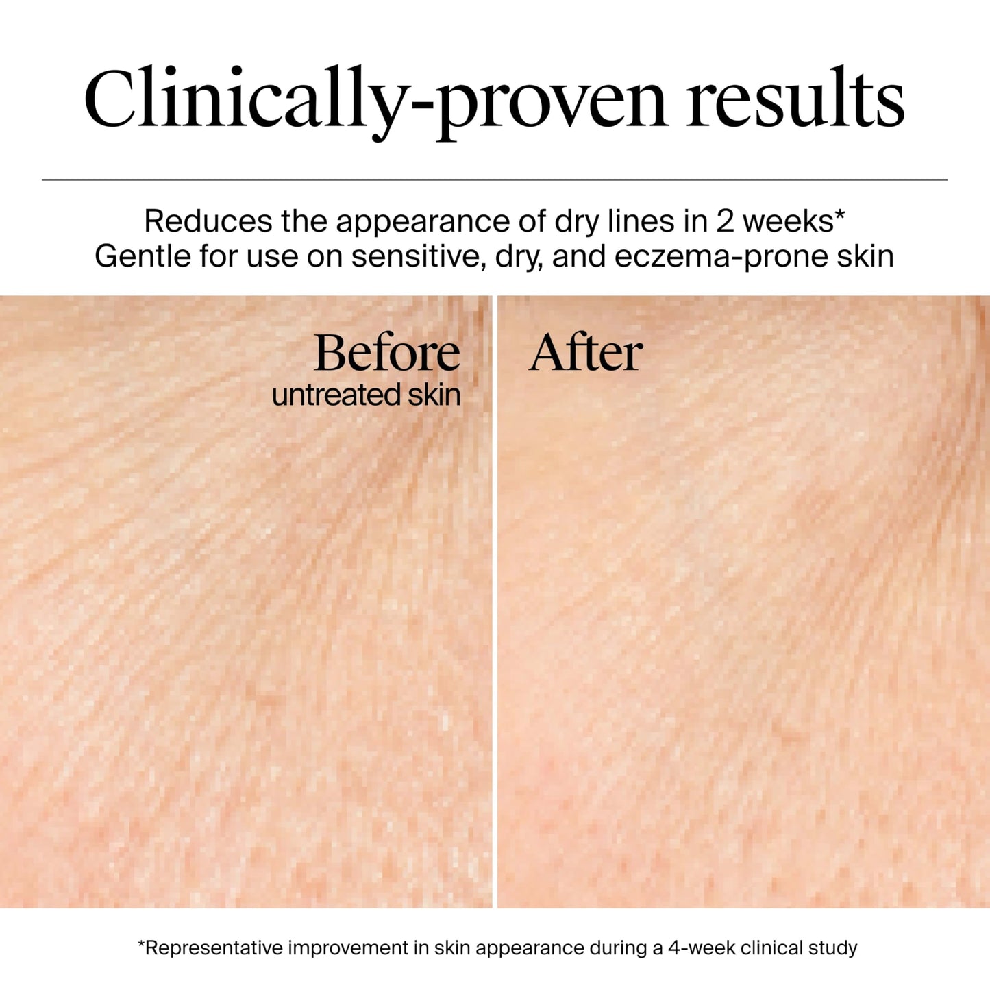 Neutrogena Hydro Boost Gel Cream 48Hr Hydration for Normal/Dry Skin, Fragrance-Free, with Hyaluronic Acid + Trial Gel Cleanser 0.5oz