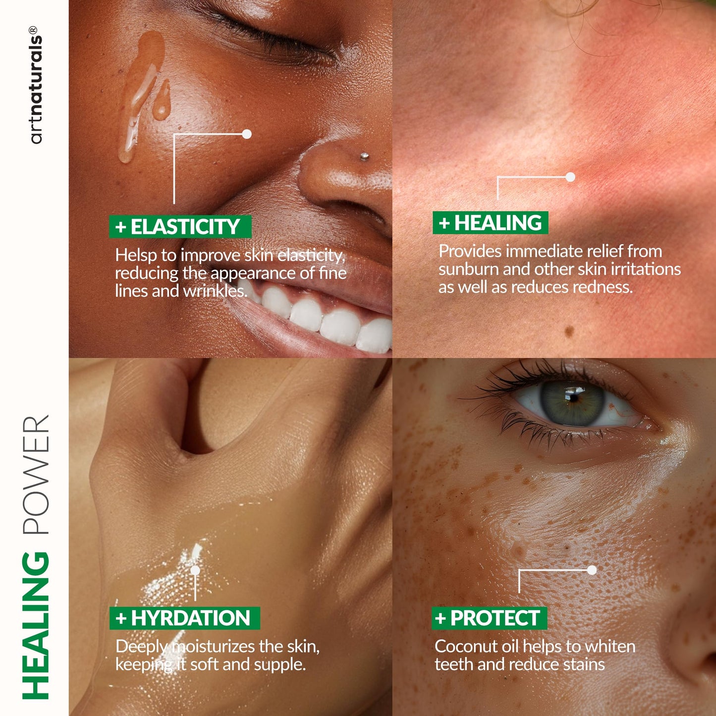 ArtNaturals Aloe Vera Gel Set, 20oz Jumbo – Soothes Sunburn, Hydrates Face, Body & Hair – Calming After-Sun Moisturizer, Freshly Harvested