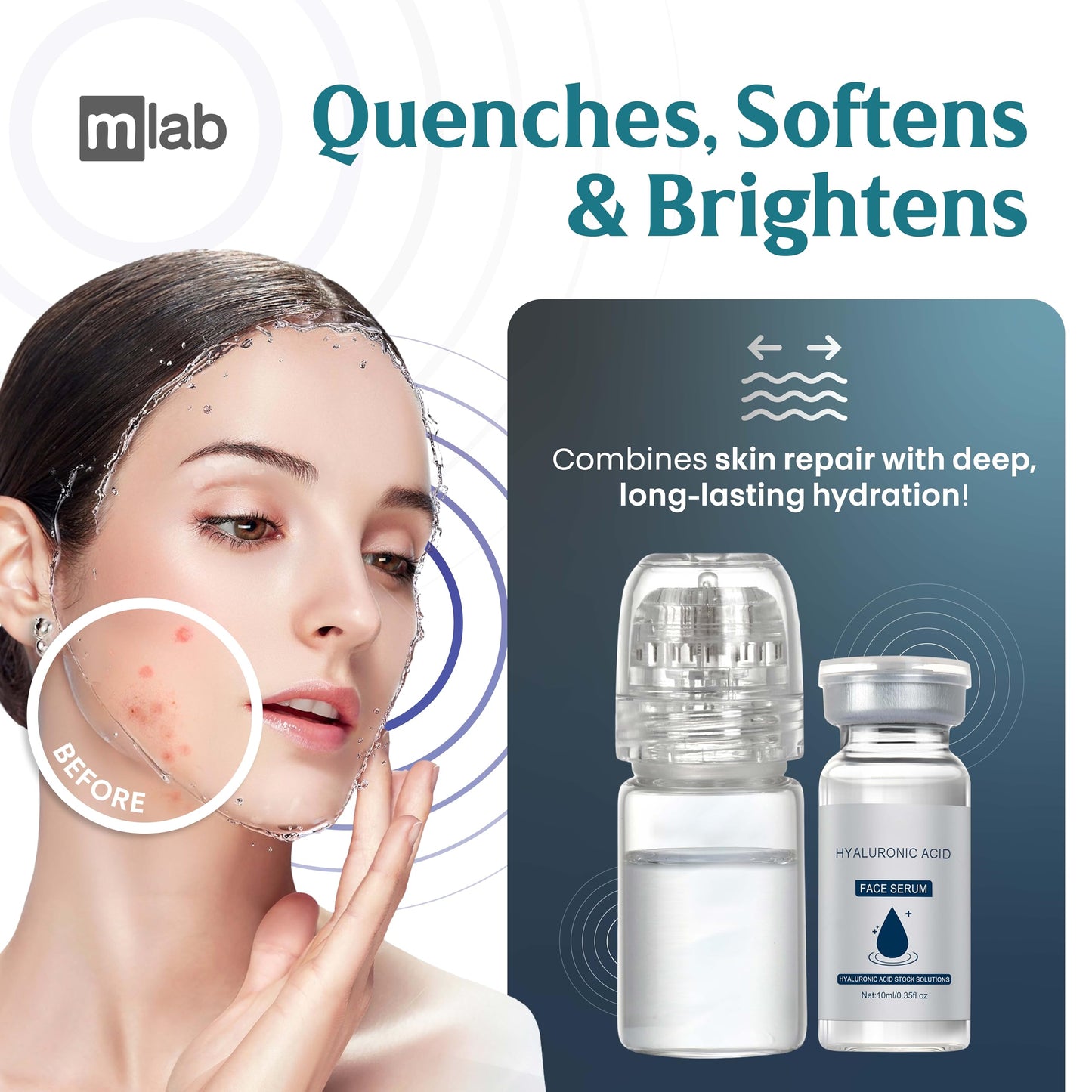 Microrevive Titanium Microneedling Kit – Home Facial System with Collagen-Boosting Derma Stamp & Hyaluronic Acid Serum, 3-Piece Set