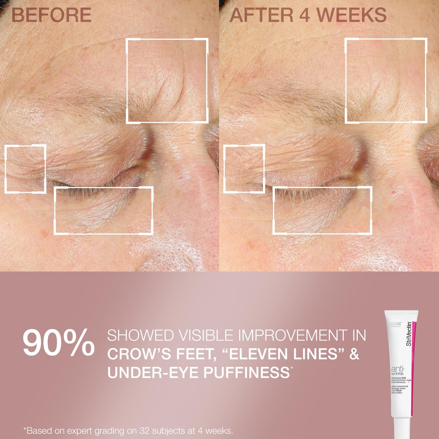 StriVectin Smooth & Hydrate Face Moisturizer and Eye Cream Skin Care 2-Piece Set