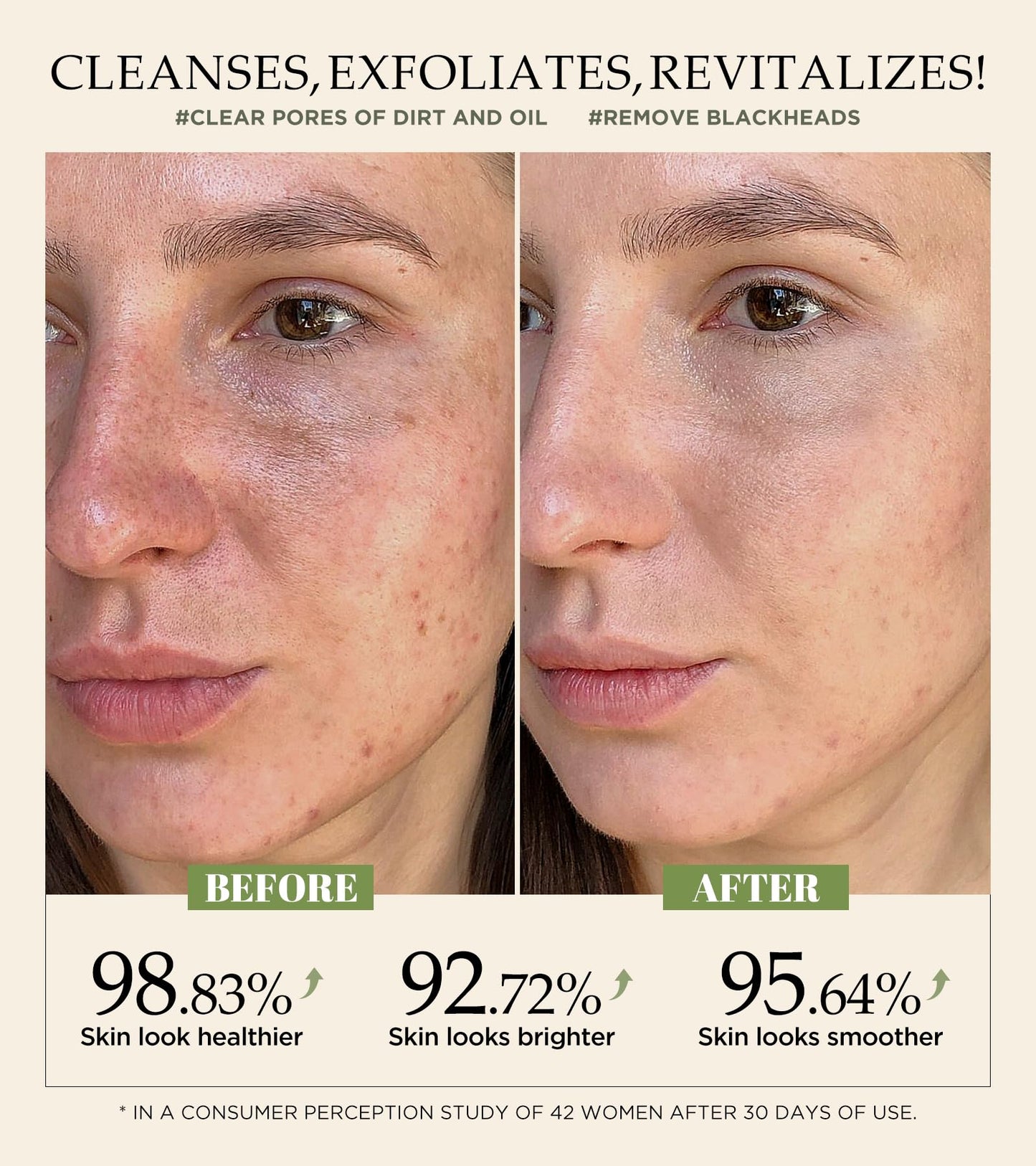 Vitamin C & Turmeric Face Scrub โ Exfoliating Scrub for Face & Body, Anti-Aging, Clears Blackheads & Dark Spots, All Skin Types, 4.23 oz