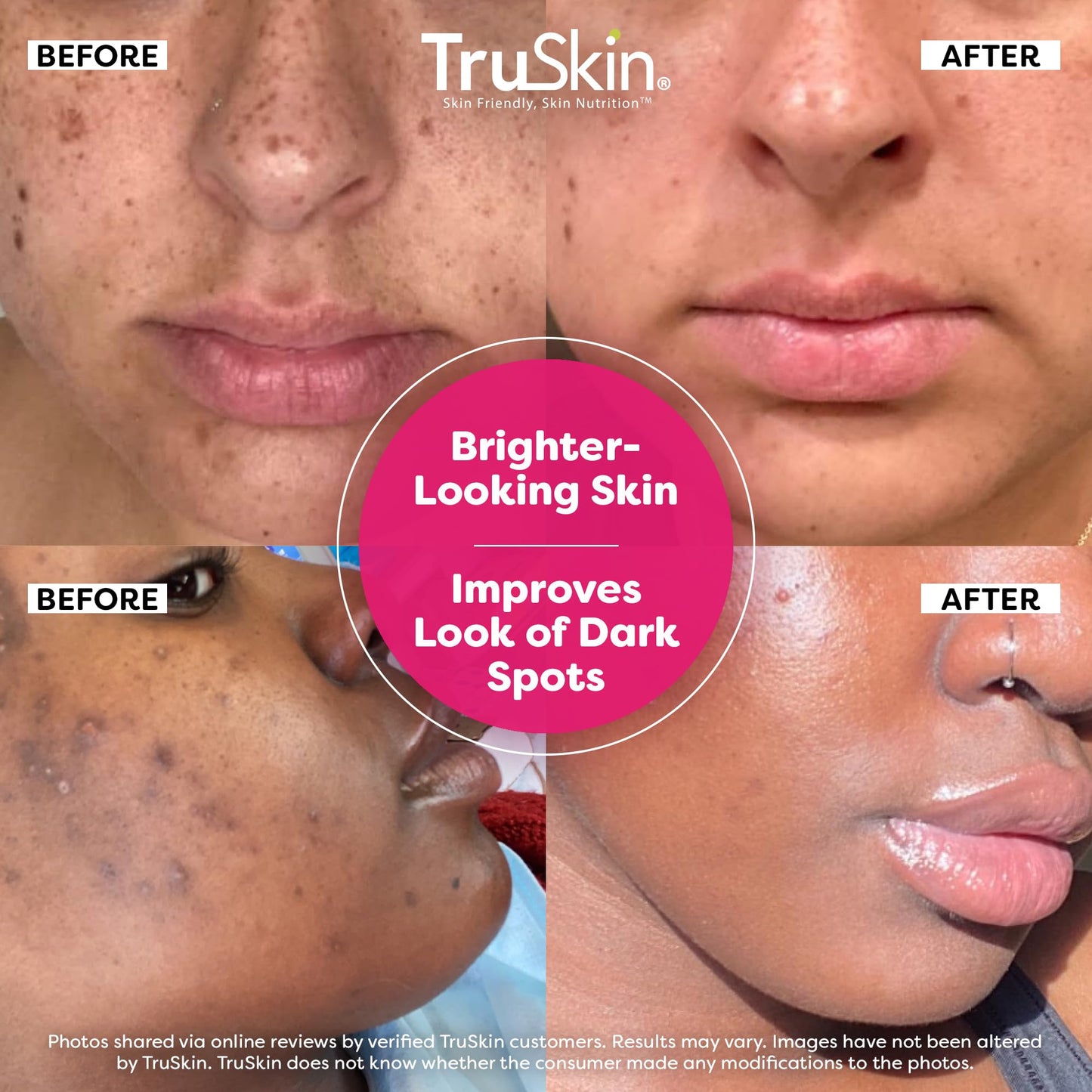 TruSkin Vitamin C Super Serum – Anti-Aging Face Serum with Niacinamide, Retinol, Hyaluronic & Salicylic Acid – Brighten & Firm Skin, 2 Fl Oz