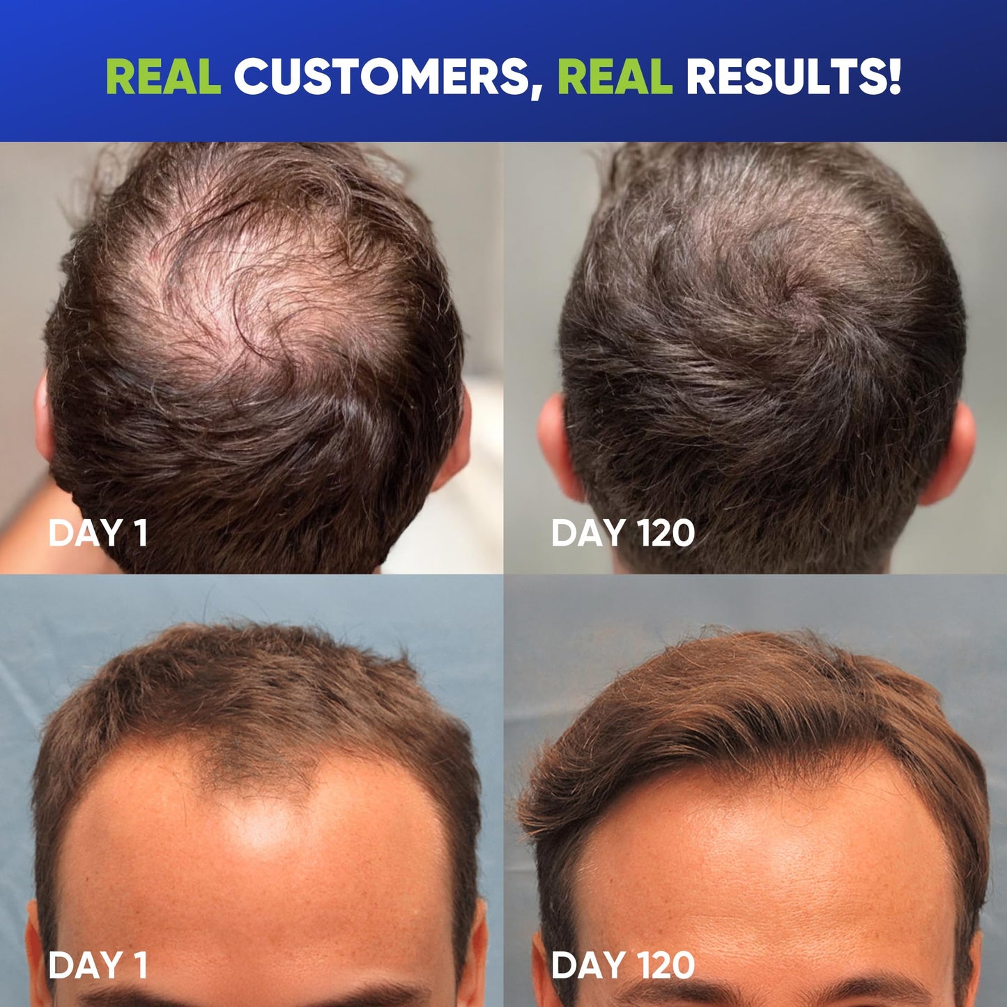 Svvimer Hair Growth Shampoo for Men with Biotin, Rosemary, Tea Tree & Caffeine – Thickening Formula for Hair Loss & Thinning, 13.5 Fl Oz