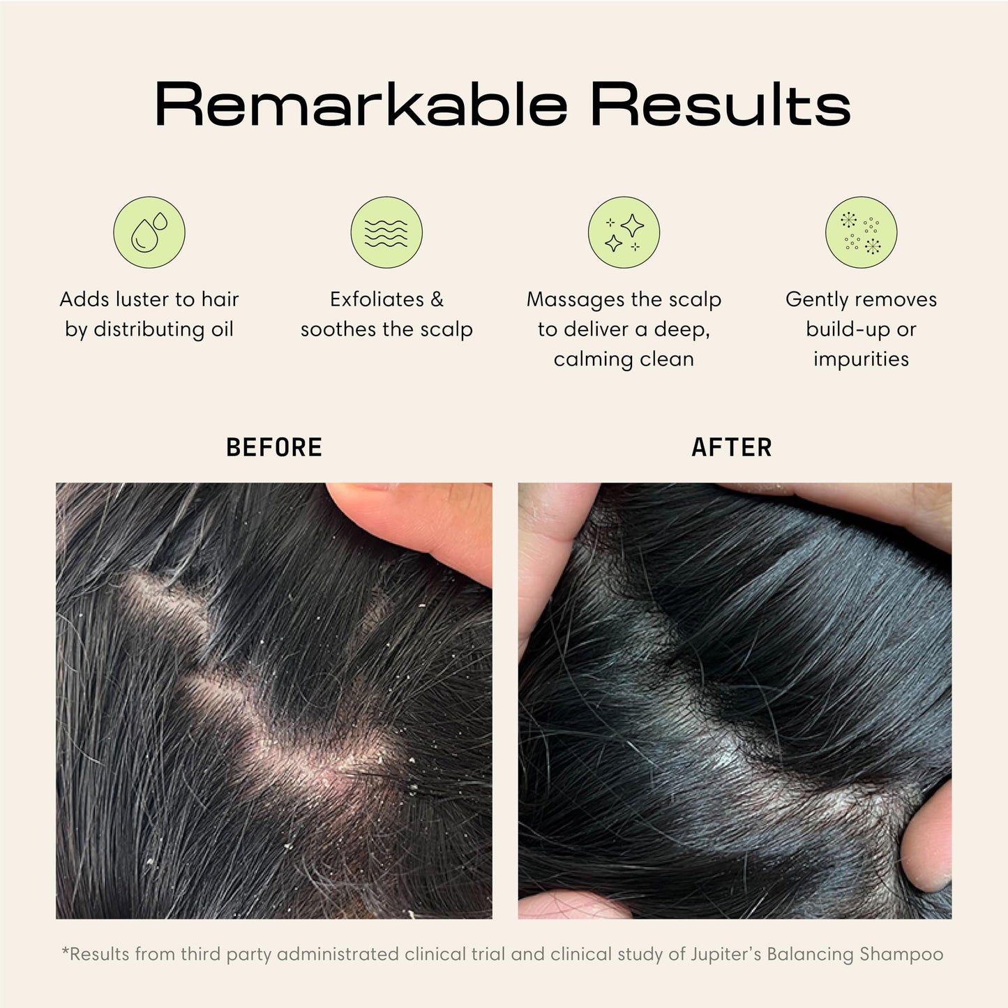 Jupiter Scalp Exfoliator Brush – Ergonomic Scalp Massager for Wet & Dry Hair, Removes Dandruff & Buildup, Boosts Circulation, Black/White