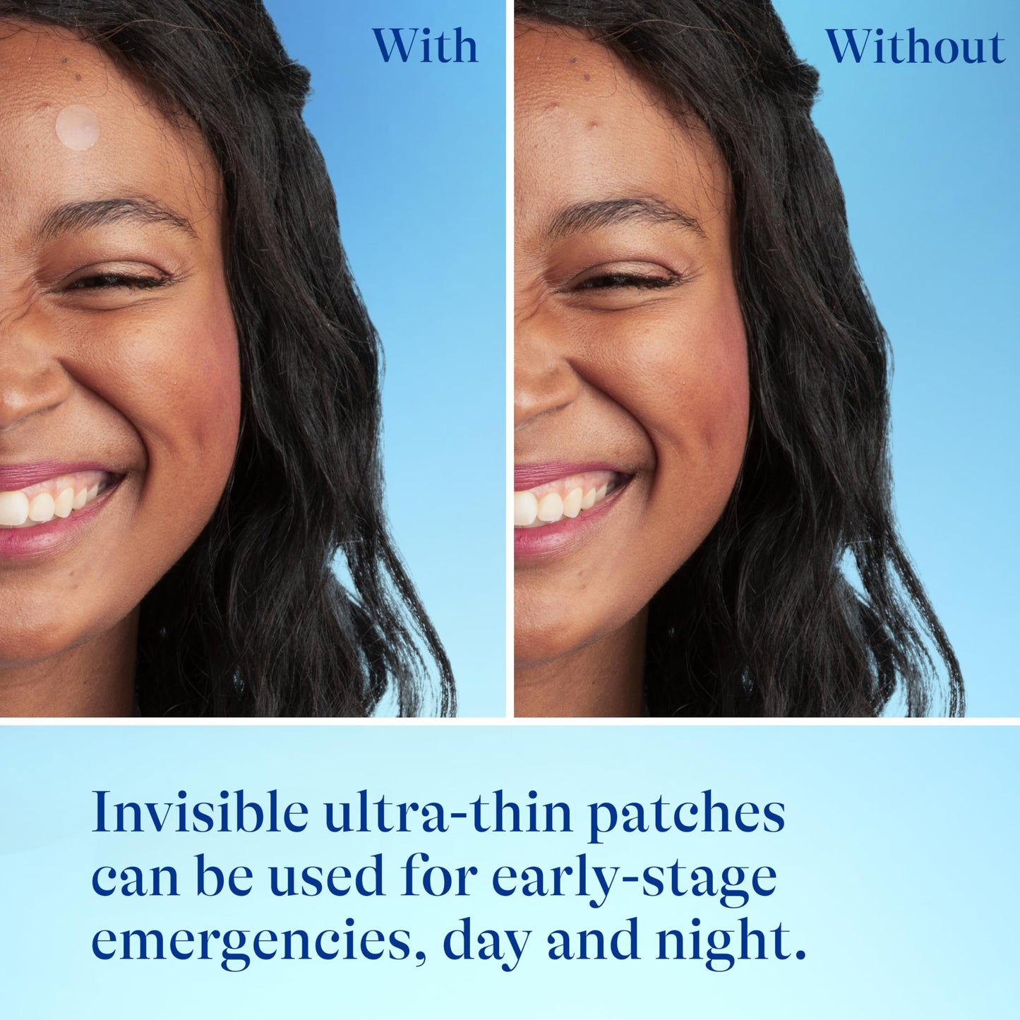 Differin Acne Patches with Salicylic Acid & Centella – Fast Triple Action Pimple Patch for Day & Night, Dermatologist Tested, 36 Count