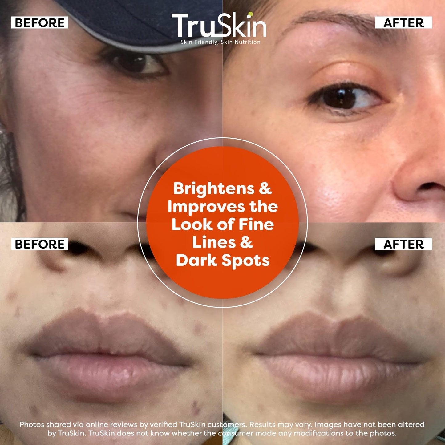 TruSkin Vitamin C Serum – Anti-Aging Face Serum with Vitamin C, Hyaluronic Acid & Vitamin E – Brightens, Fades Dark Spots, Smooths Skin, 2oz