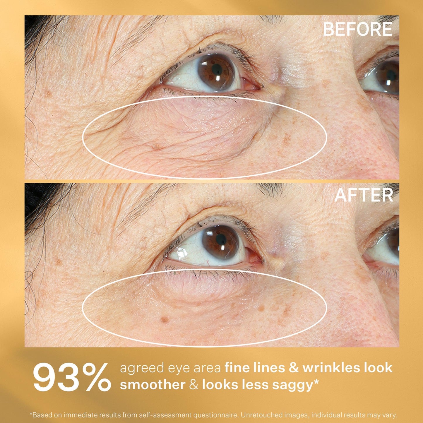 StriVectin Tighten & Lift Hyperlift Eye Cream Instant Eye Fix, Tightening Treatment for Bags, Lines and Crepiness, 0.34 Fl Oz,(Pack of 1)