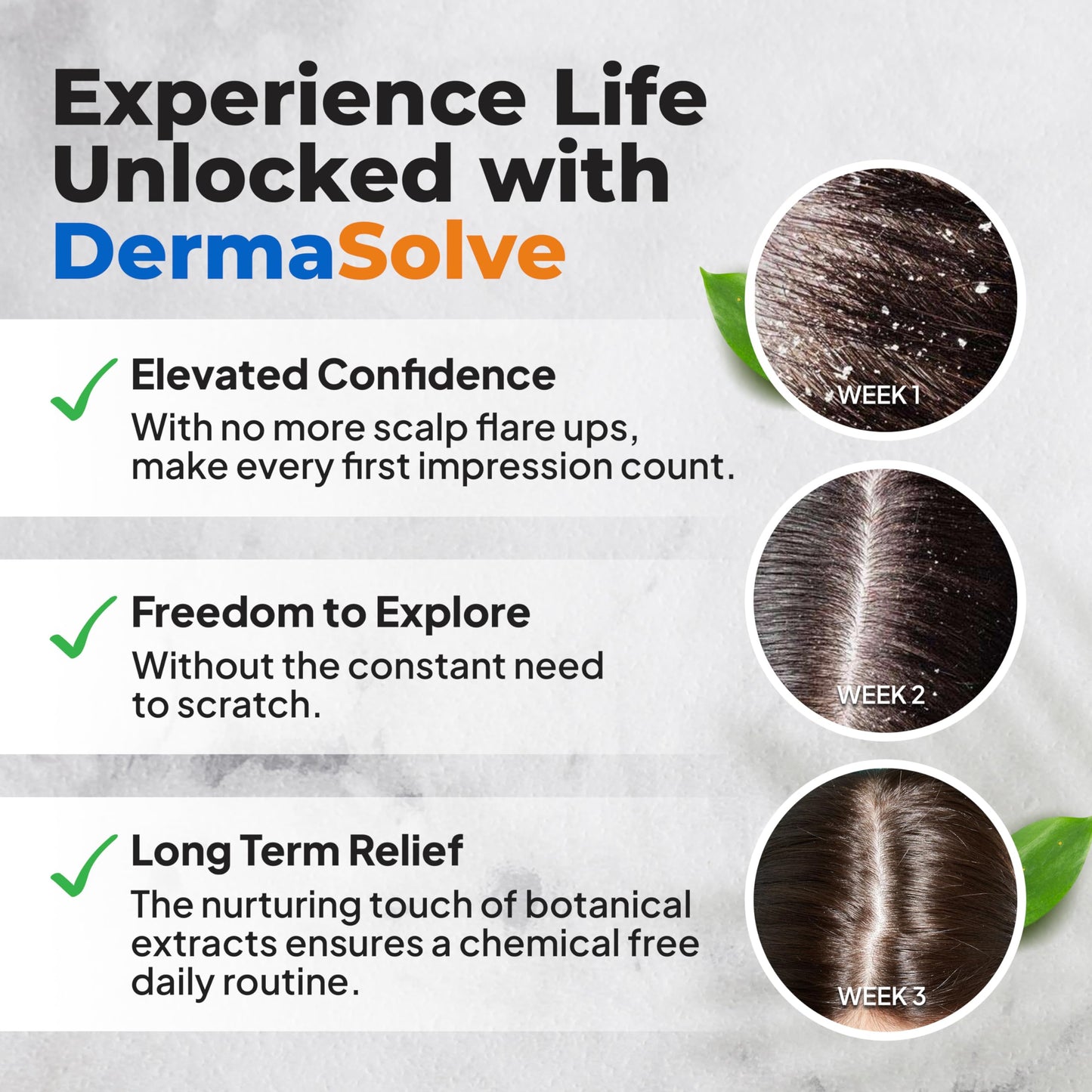 Dermasolve Scalp Oil 4 oz – Psoriasis, Seborrheic Dermatitis & Dandruff Relief – Dermatologist Approved, Itch-Free, Flake Control Formula