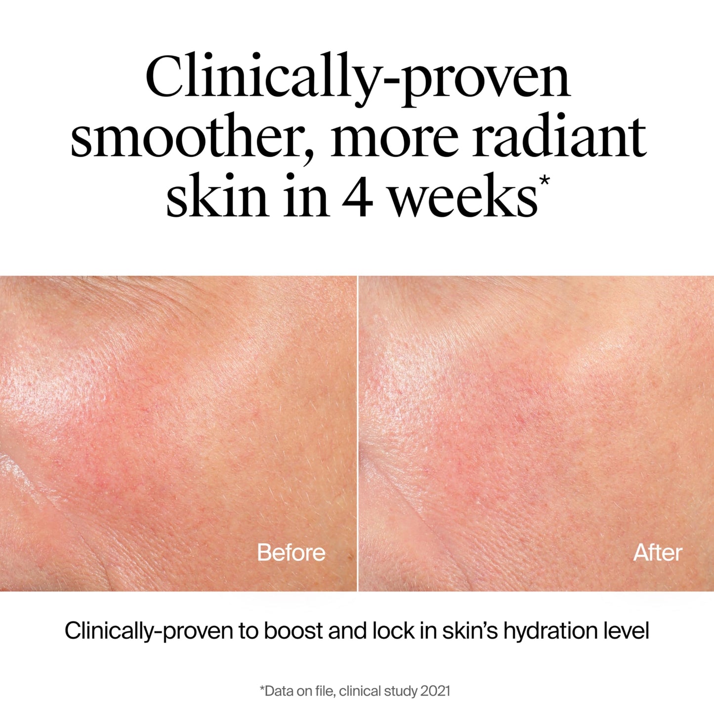 Neutrogena Hydro Boost Hydrating Face Wash & Makeup Remover Gel with Hyaluronic Acid, Gentle, Oil-Free, Hypoallergenic, 7.8 fl oz