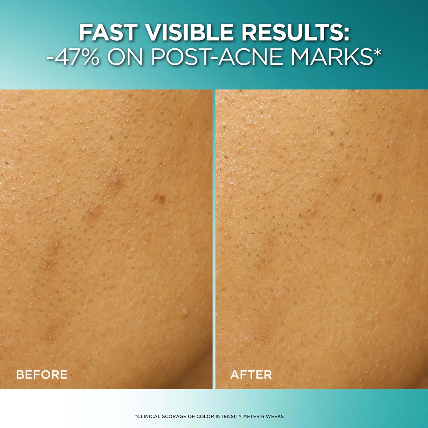 L'Oreal Paris Bright Reveal Dark Spot Exfoliant Peel with 25% AHA BHA PHA – Gentle Face Exfoliator, Reduces Dark Spots + SPF Sample