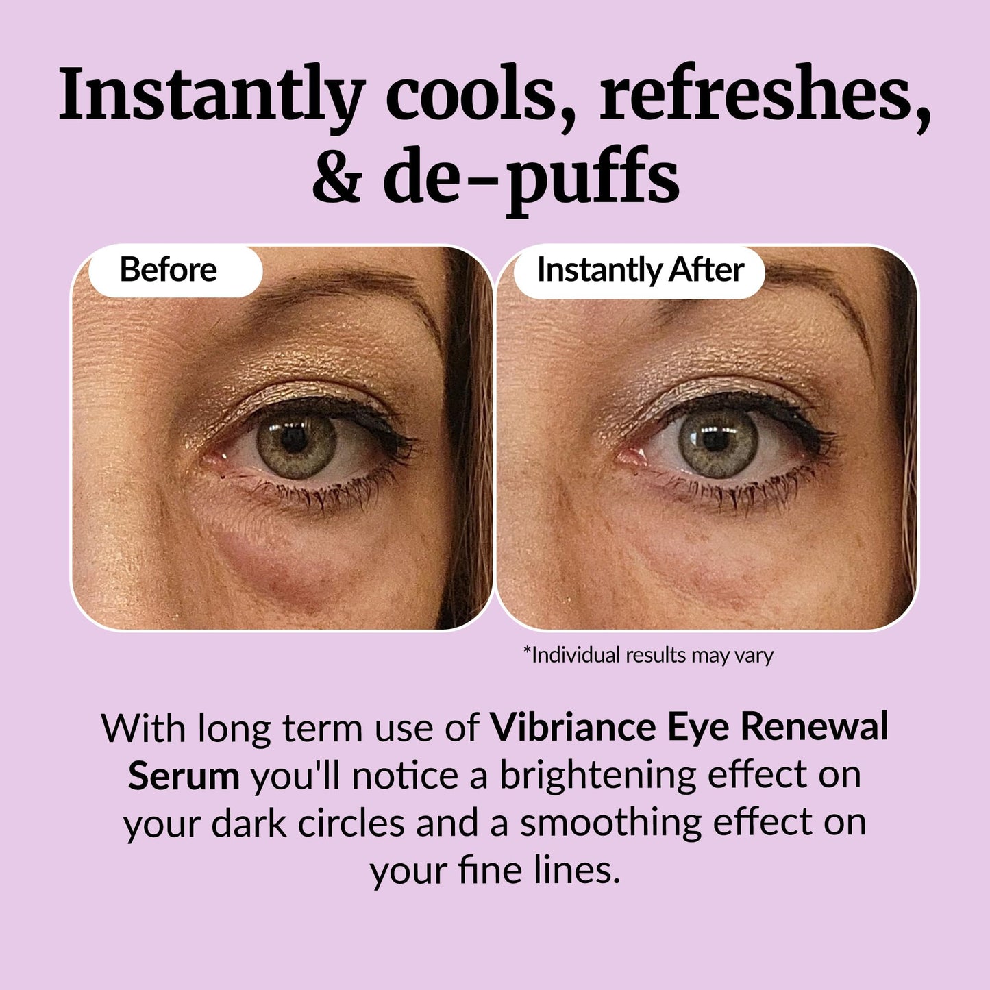Vibriance Eye Renewal Serum - Dark Circles and Puffiness Treatment - Caffeine Formula for Reducing Bags