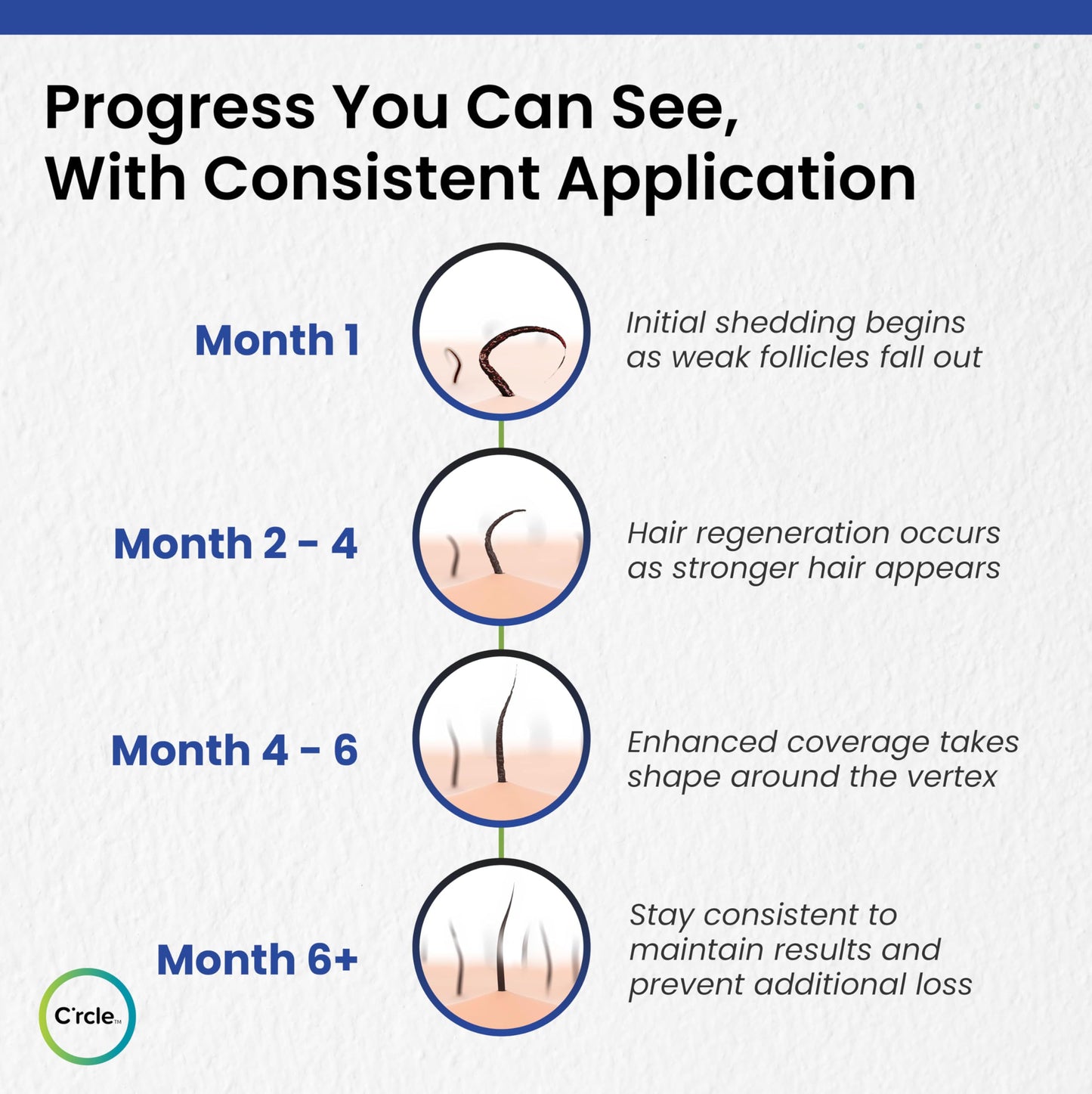Minoxidil 5% Foam for Men – Unscented, Extra Strength Hair Regrowth Treatment – 3 Month Supply for Thinning & Vertex Hair Loss