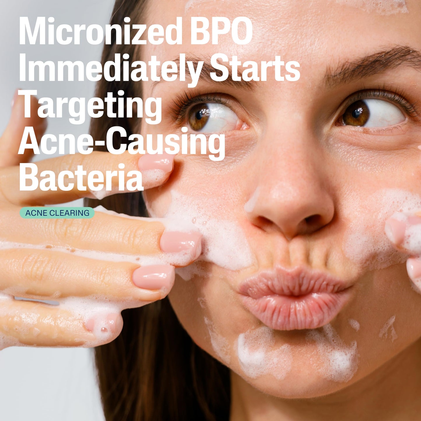 Cetaphil Gentle Clear Acne Cleanser with 2.6% Benzoyl Peroxide – Creamy, Soothing Face Wash for Sensitive & All Skin Types, 4.2 oz