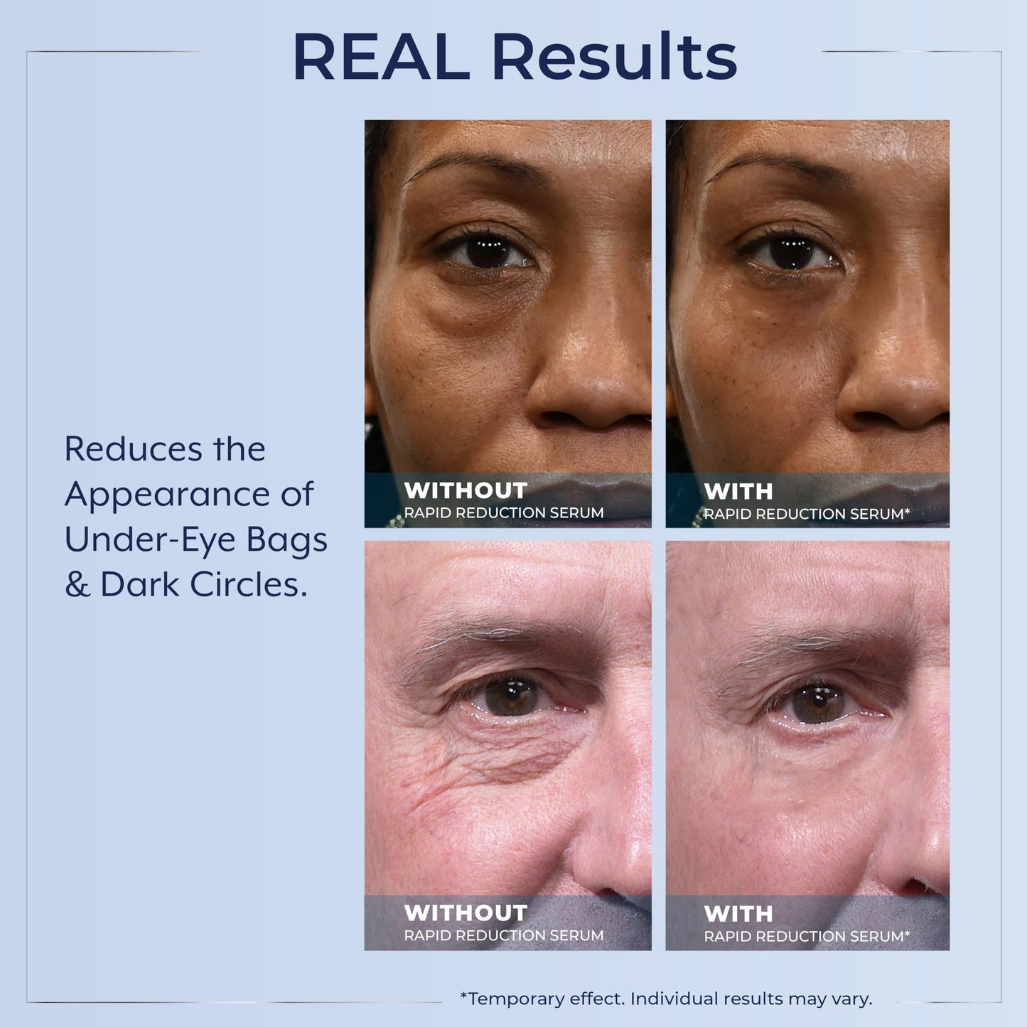 Plexaderm Rapid Reduction Eye Serum – Instantly Reduces Under-Eye Bags, Wrinkles, Dark Circles & Fine Lines, 30 Single-Use Pods