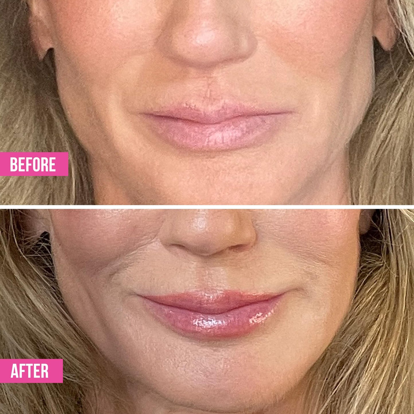 Vibriance Hydrating Lip Volumizer - Plumping Gloss with Hyaluronic Acid - Plumper Smooths Lines and Wrinkles, 0.14 fl oz