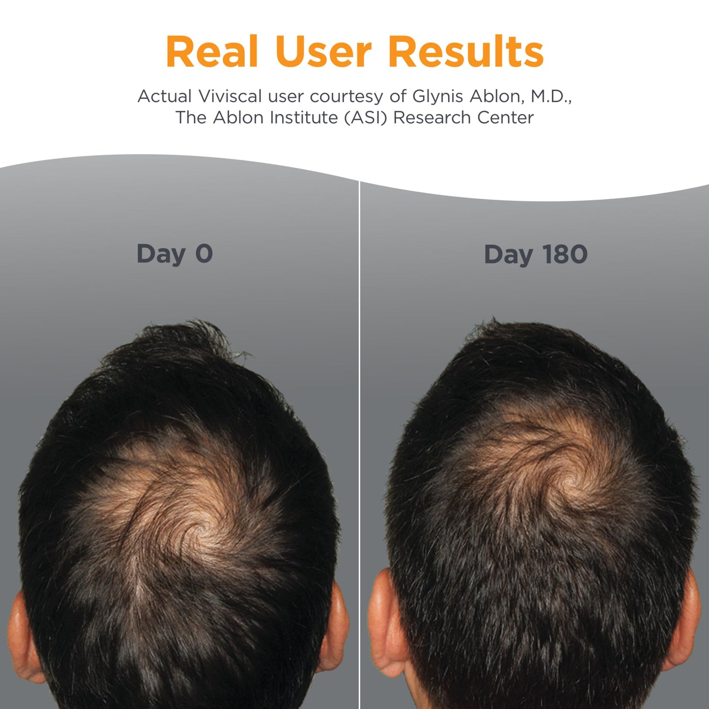 Viviscal Men's Hair Growth Supplements for Thicker Fuller Hair, Clinically Proven Collagen Complex, 60 Tablets 1 Month Supply