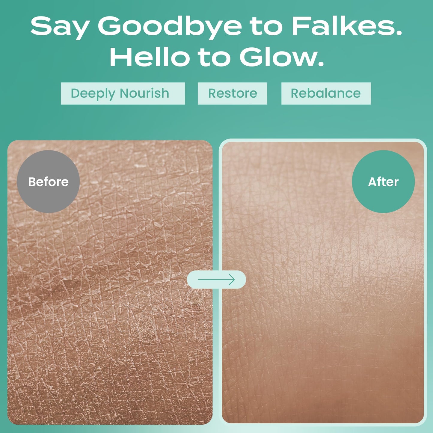 Body Restore Whipped Grass-Fed Beef Tallow for Dry Skin, Face & Body with Manuka Honey, Jojoba & Eucalyptus – Travel, Gifts & Stocking Stuffers