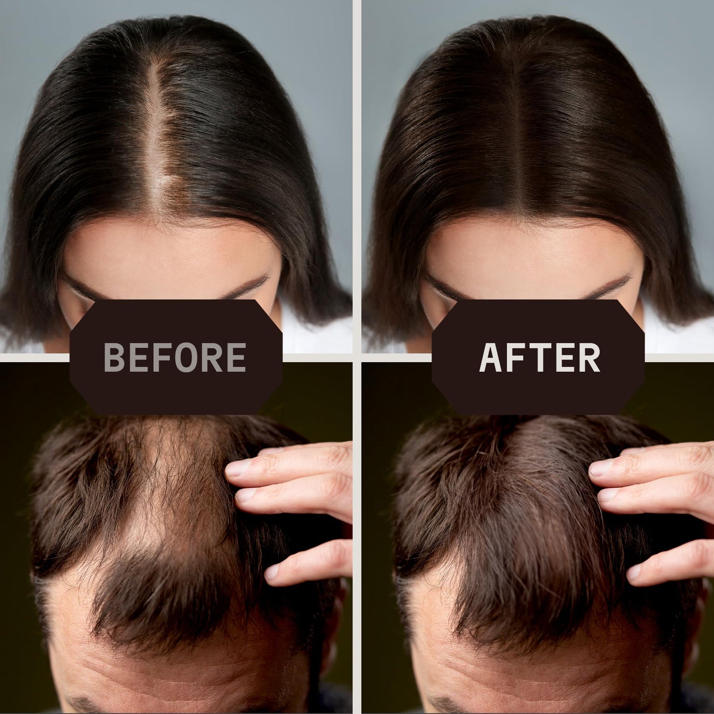 Striking Viking Hair Building Fibers for Thinning Hair - Dark Brown, 0.98 oz – Long-Lasting, Natural Hair Filler Powder for Men & Women