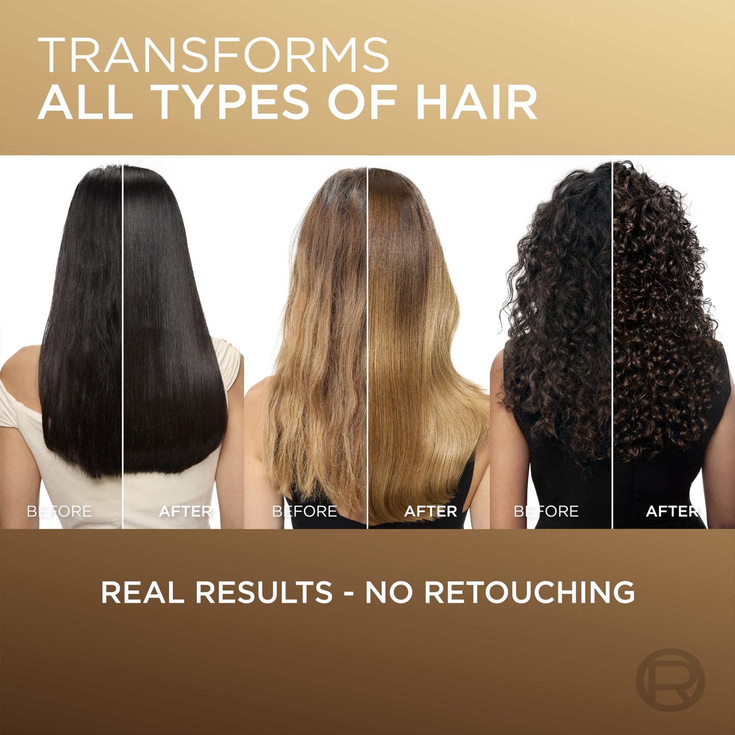 L'Oreal Paris Elvive Total Repair 5 Damage-Erasing Balm with Almond and Protein, 8.5 Ounce (Packaging May Vary)