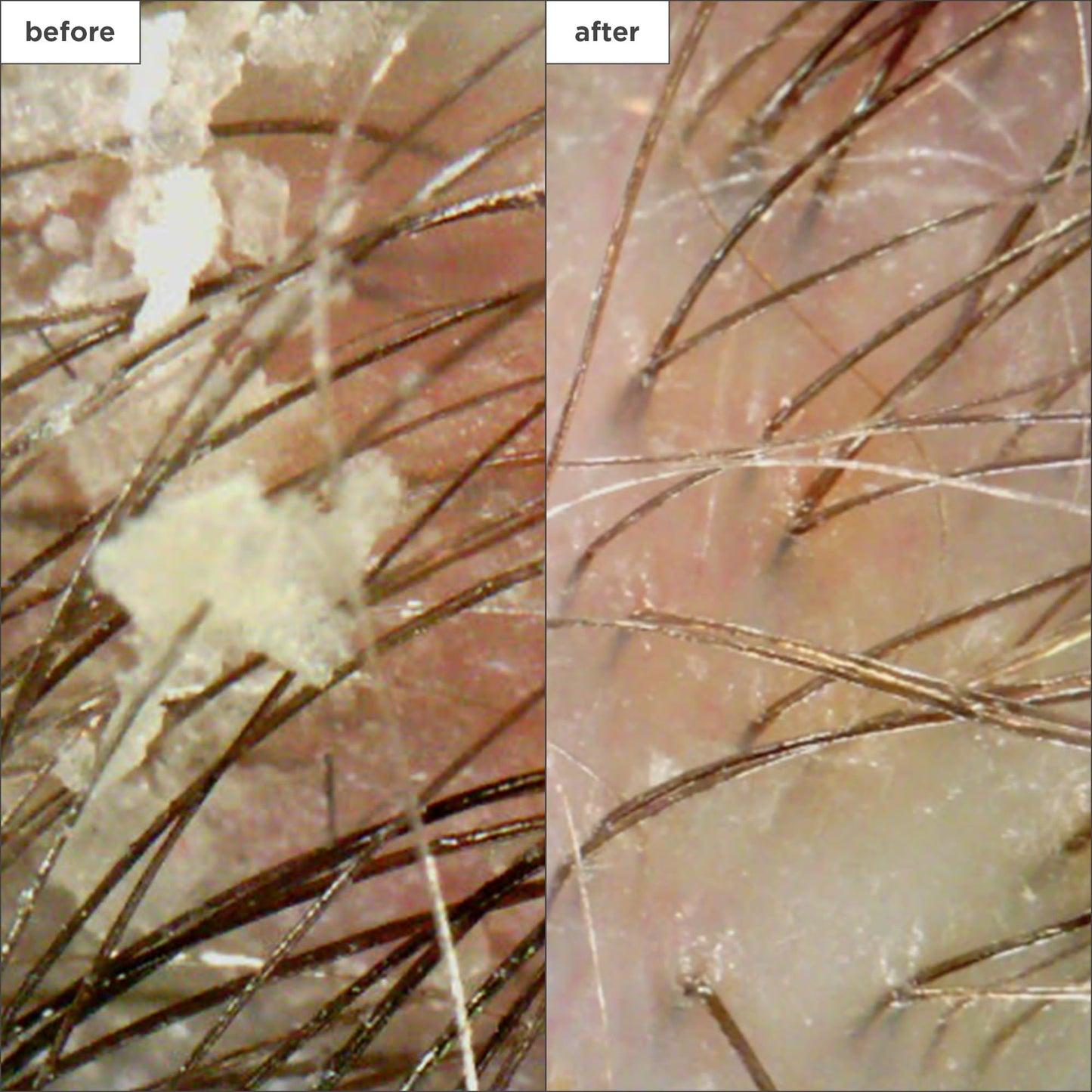 Briogeo Scalp Revival Charcoal + Coconut Oil Exfoliating Shampoo – Clarifies Build-Up, Soothes Dry Itchy Scalp, Vegan & Cruelty-Free, 2 fl oz