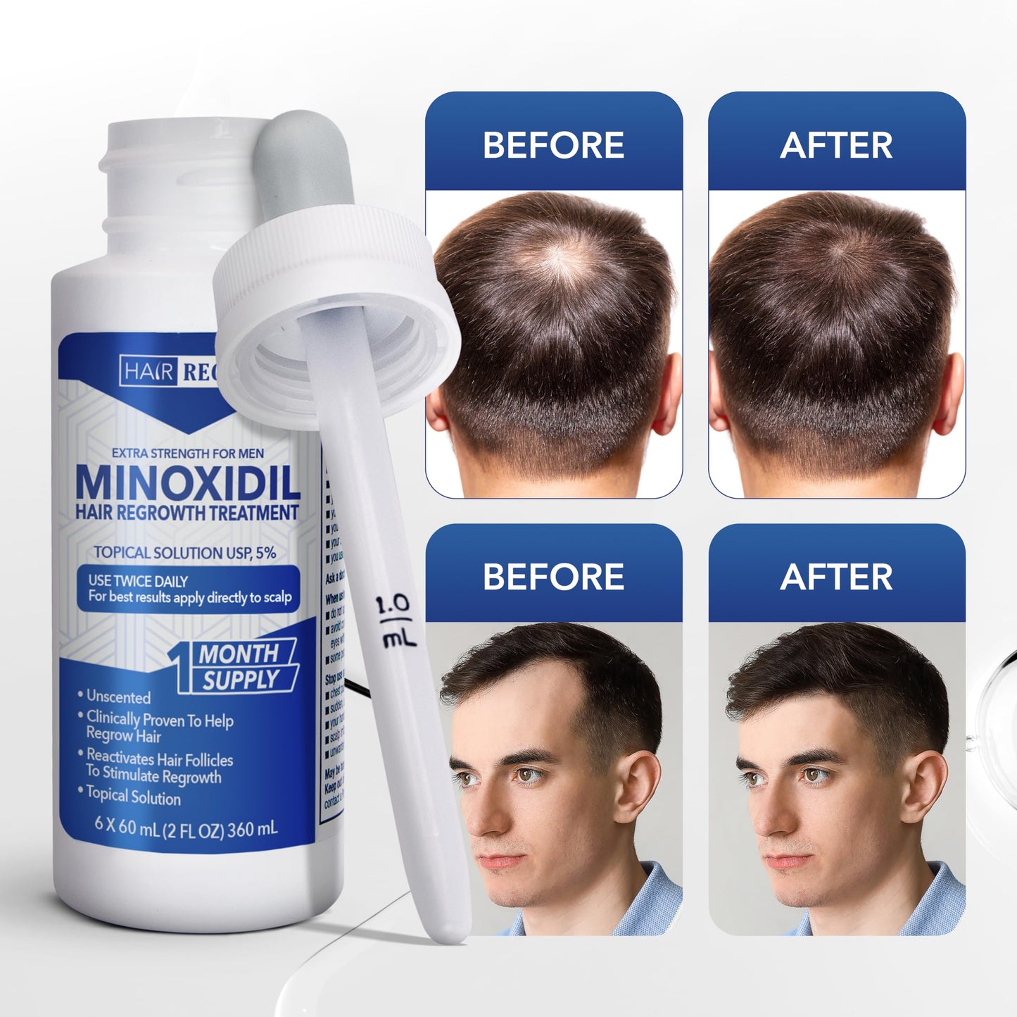Hair-Regen 5% Minoxidil for Men – Hair Regrowth Treatment for Thinning Hair, 6-Month Supply, Thicker Fuller Hair
