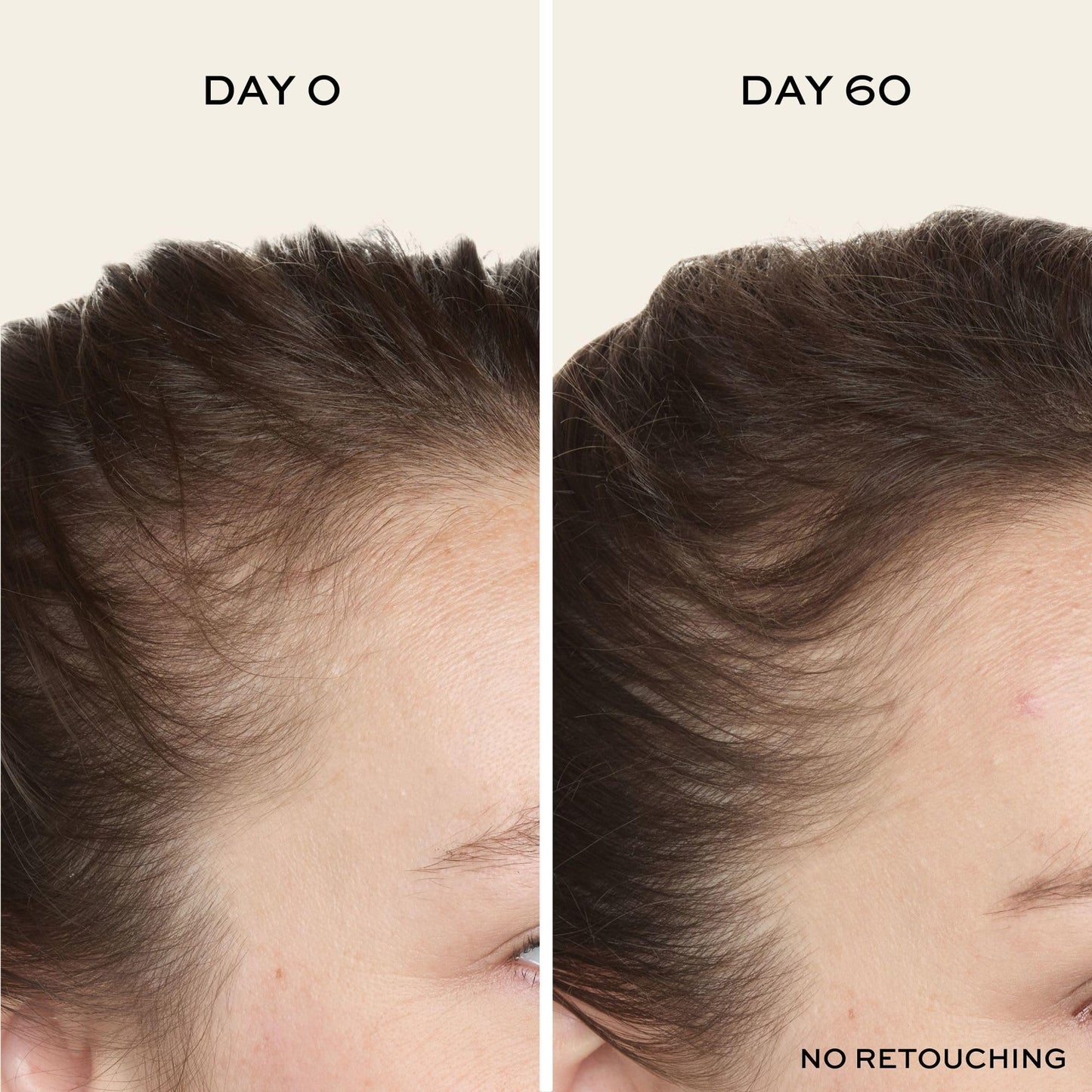 John Frieda ULTRAfiller+ Hair Density Scalp Serum for Fine Hair, Volumizing Hair Serum, Scalp Treatment for Thickening for Women and Men, 2 Oz