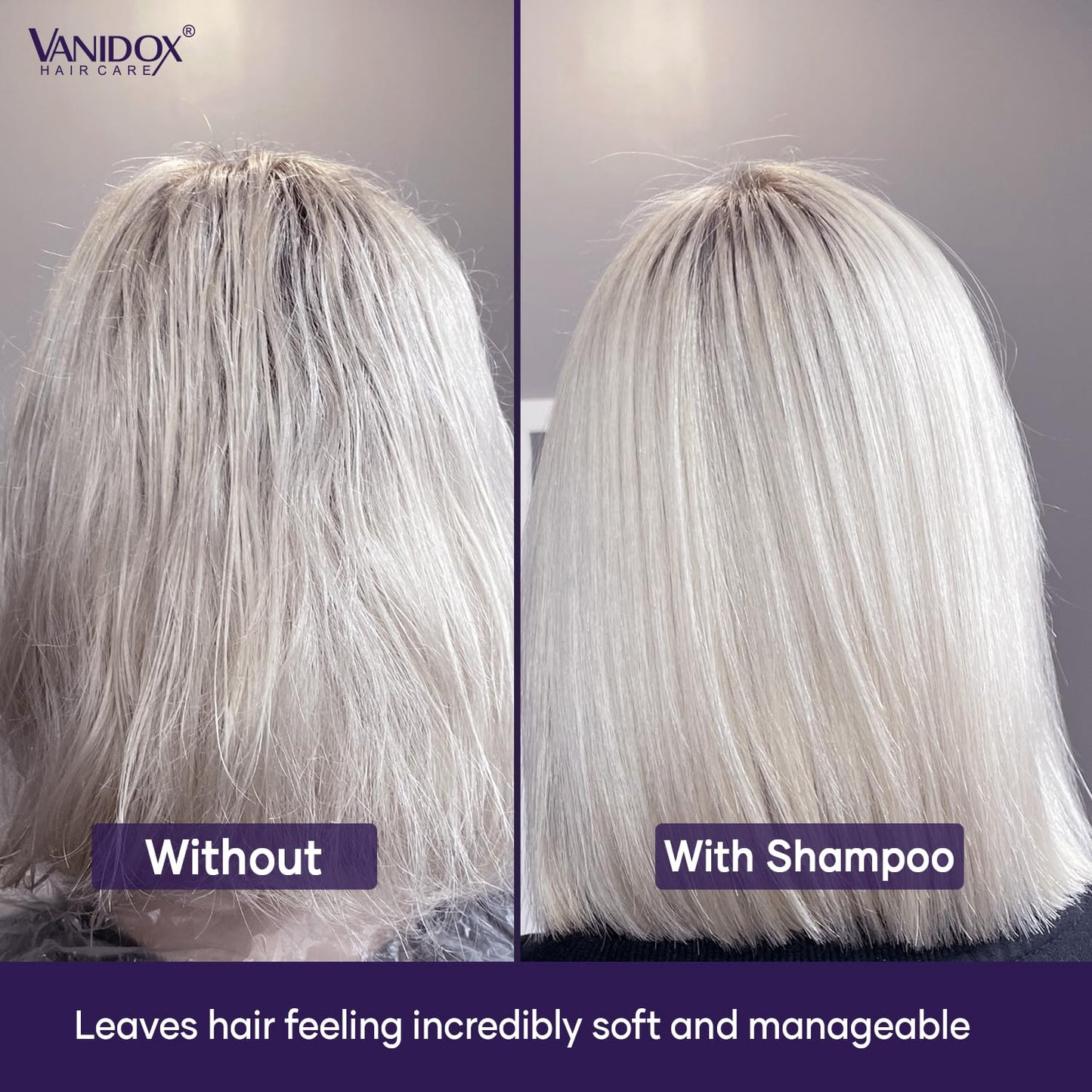 VANIDOX Purple Shampoo & Conditioner Set for Gray & Silver Hair, Sulfate-Free, Moisturizing, Color-Safe, Boosts Shine & Brightness, 16 fl oz Each