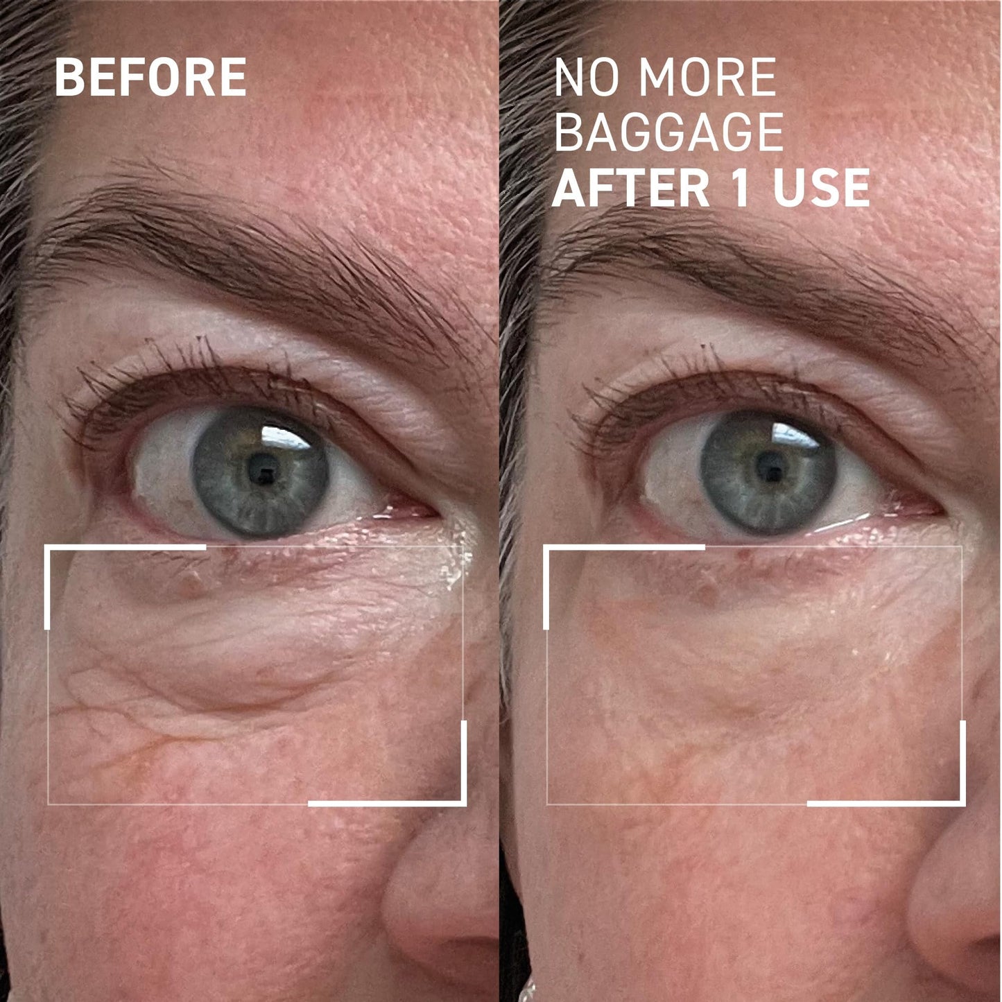 Dr. Brandt Needles No More, No More Baggage - Minimizes Under-Eye Bags, Puffiness & Dark Circles - 0.5 oz