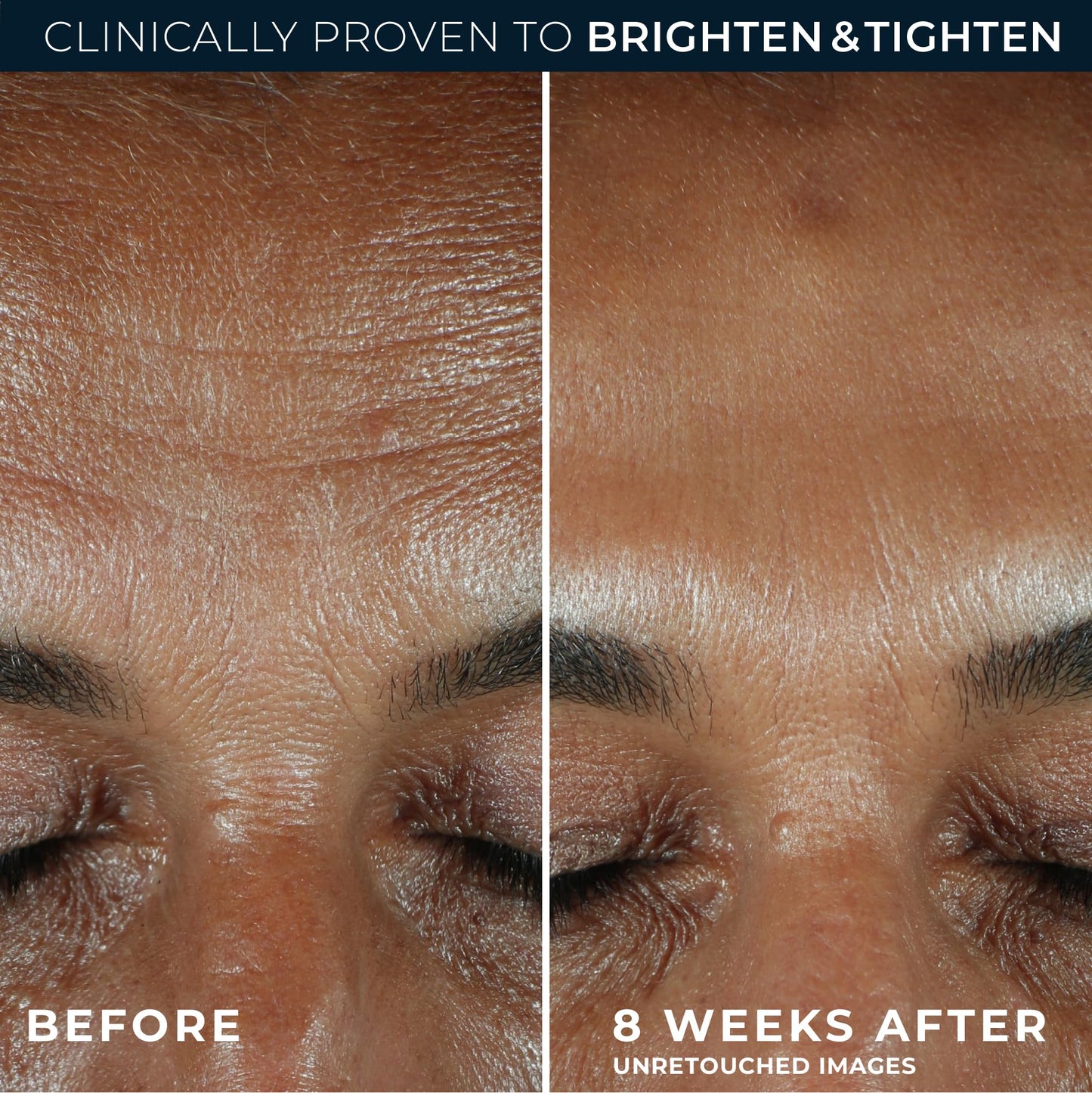 RoC Multi Correxion Revive + Glow Vitamin C Serum 10% – Daily Anti-Aging, Wrinkle & Brightening Face Treatment, 1 fl. oz