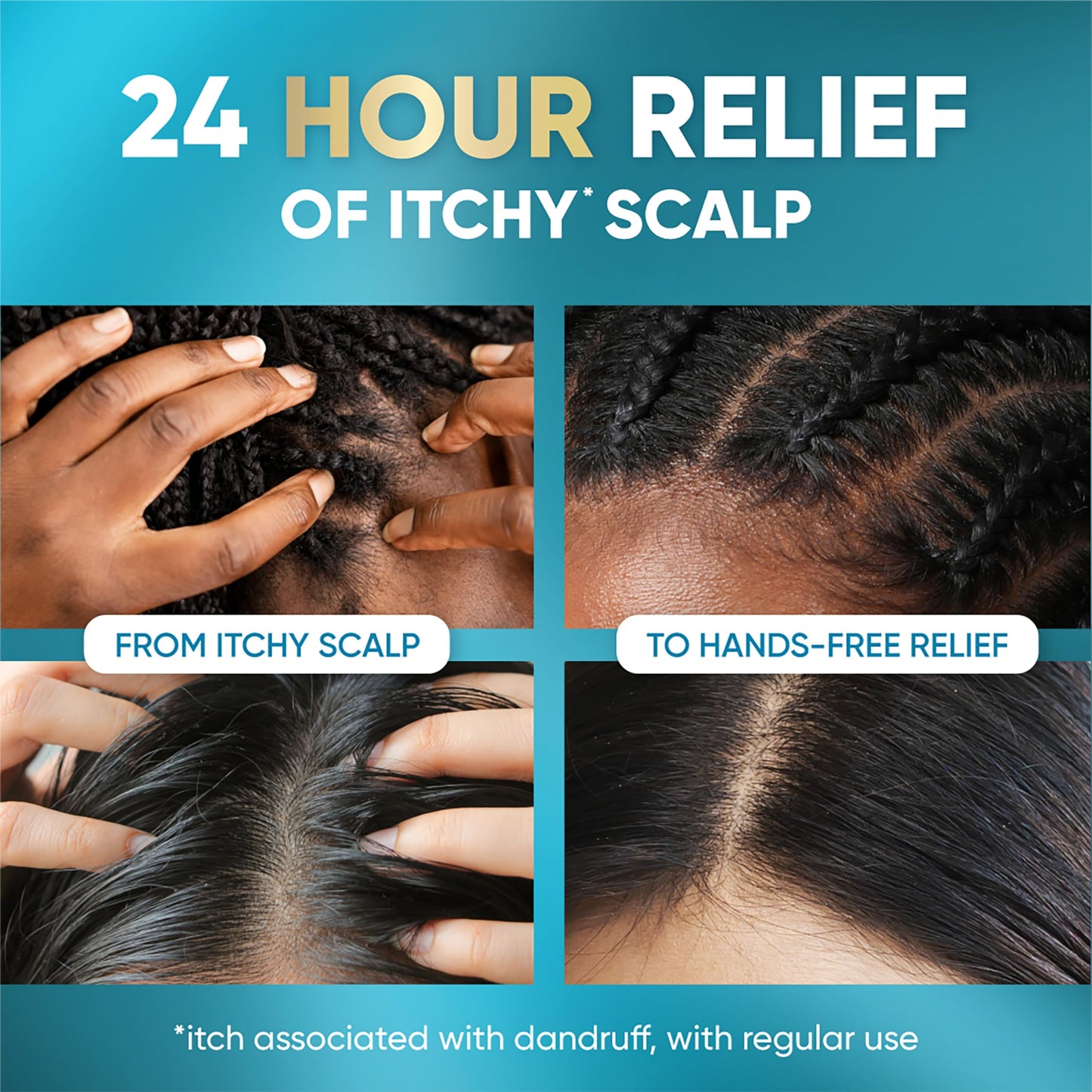 Head & Shoulders Royal Oils Scalp Elixir Treatment 4.2 fl oz | Anti-Dandruff, Dry Scalp Relief & Hydration with Menthol & Peppermint Oil