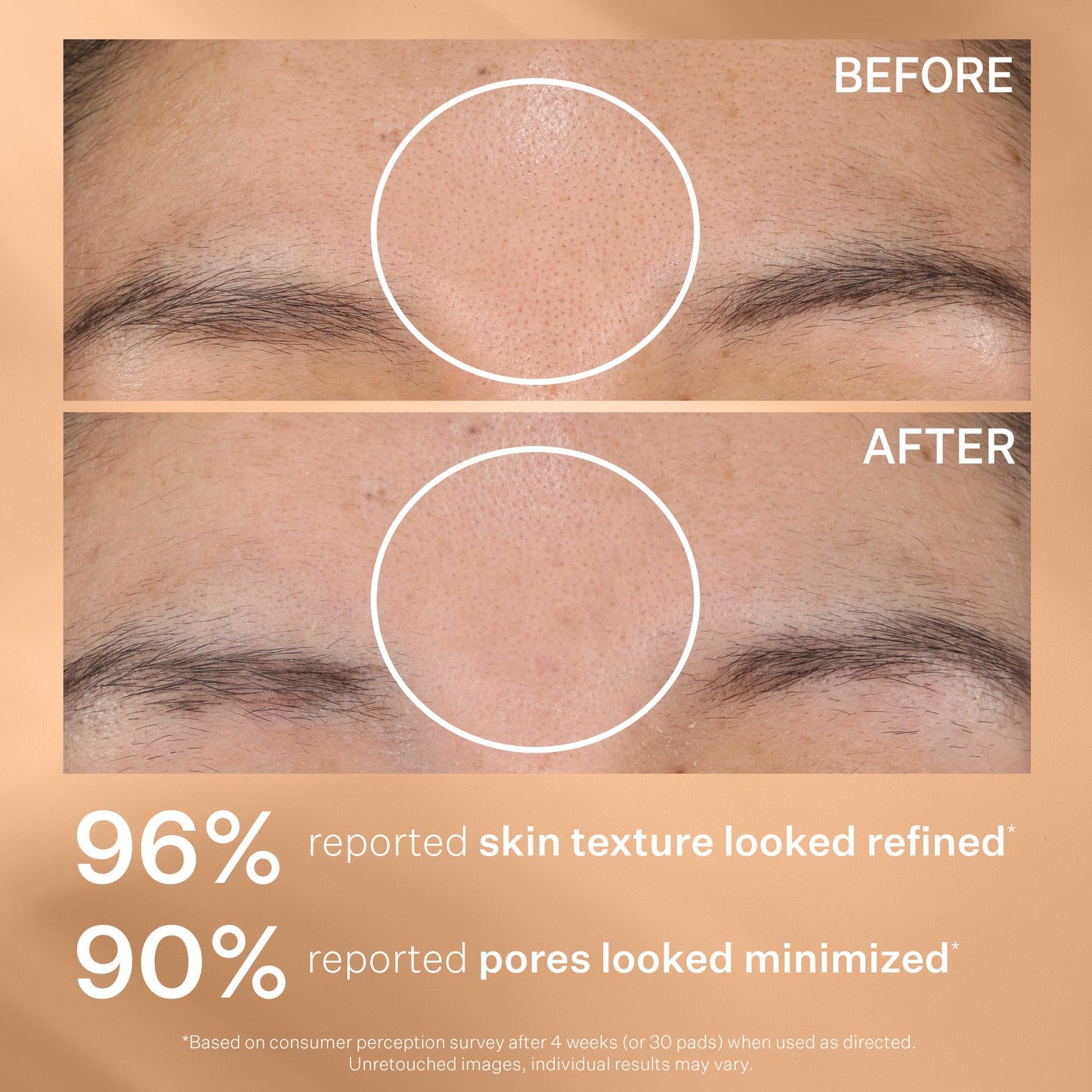 StriVectin Advanced Resurfacing Daily Reveal Exfoliating Face Pads, Visibly Smooths and Brightens Skin, Reduces Blackheads, Salicylic Acid, 60 Count