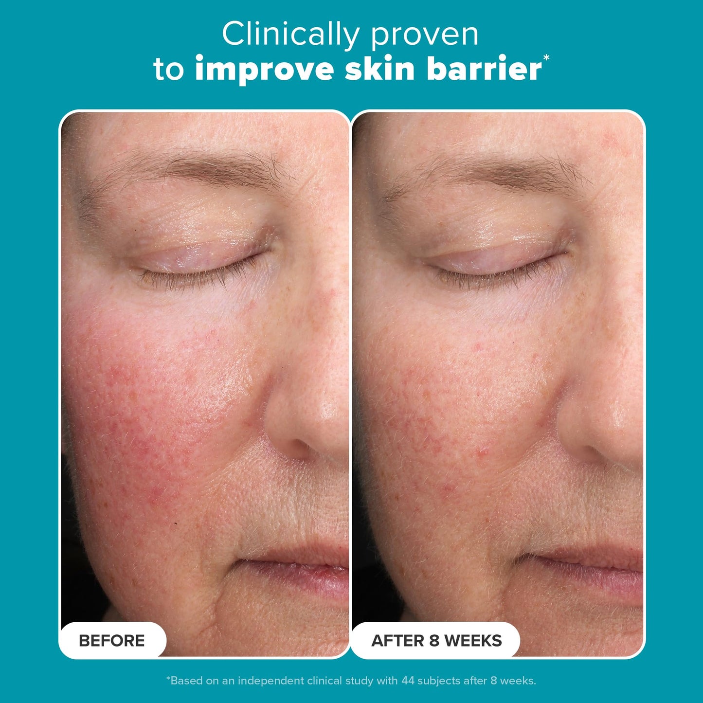 Paula’s Choice Mandelic + Lactic Acid Exfoliant 6%/2% – Gentle Daily AHA for Discoloration, Texture & Radiance, Sensitive Skin, 3 fl oz