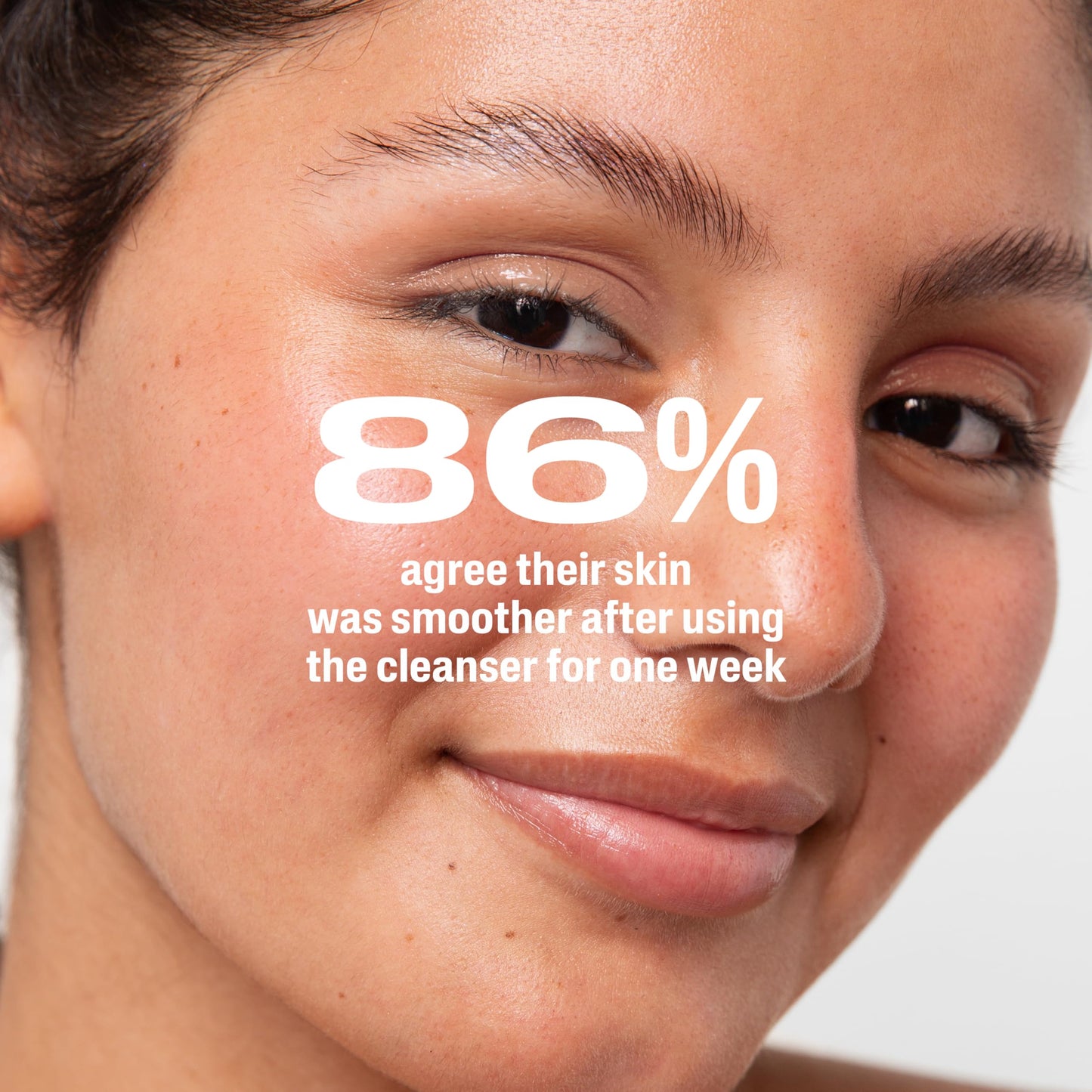 Cetaphil Gentle Clear Acne Cleanser with 2.6% Benzoyl Peroxide – Creamy, Soothing Face Wash for Sensitive & All Skin Types, 4.2 oz