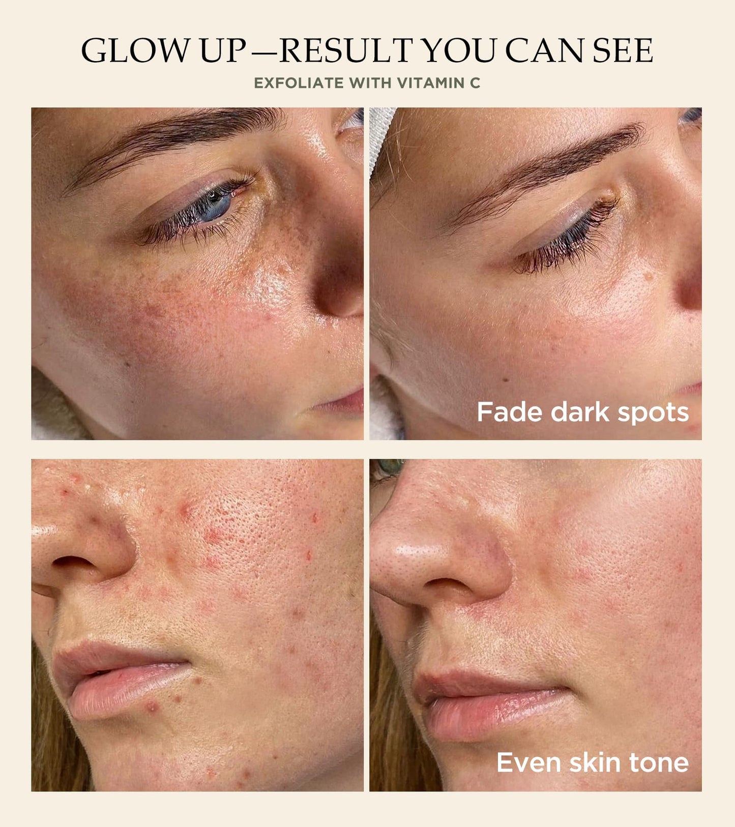 Vitamin C & Turmeric Face Scrub โ Exfoliating Scrub for Face & Body, Anti-Aging, Clears Blackheads & Dark Spots, All Skin Types, 4.23 oz