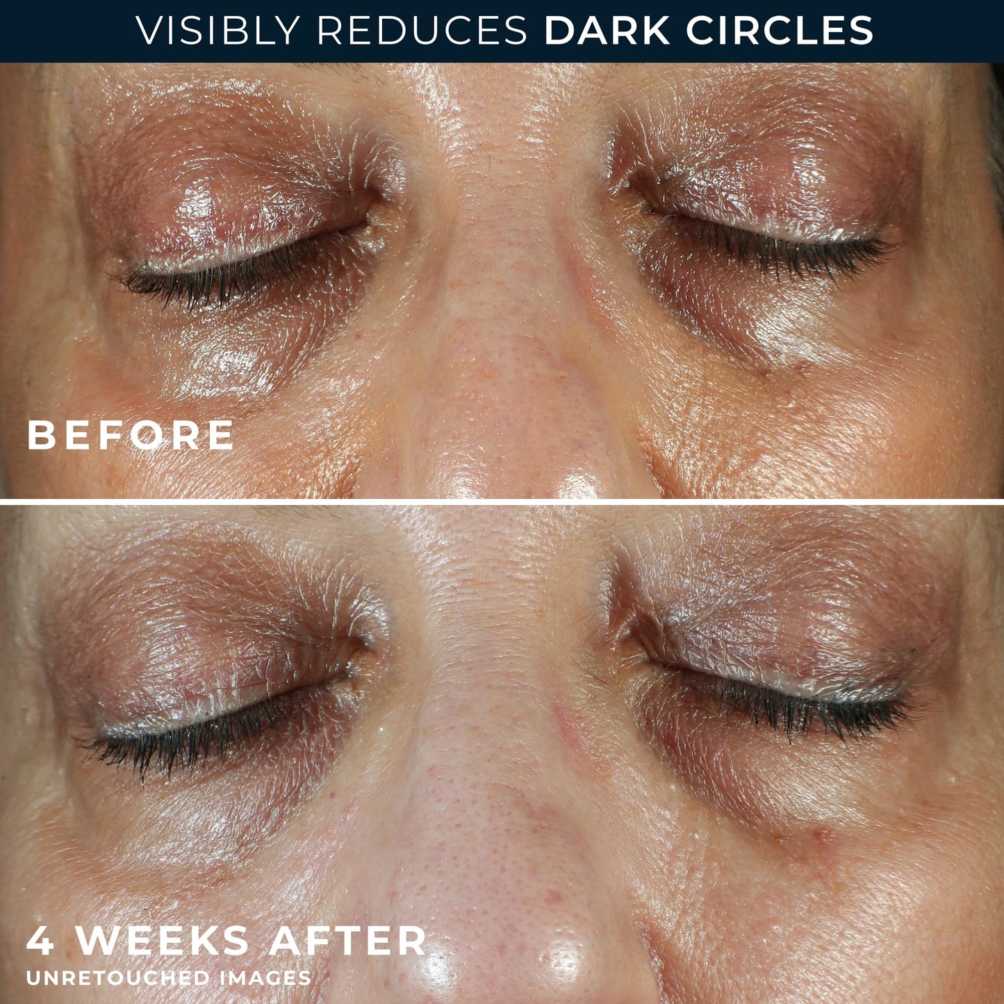 RoC Multi Correxion 5-in-1 Anti-Aging Eye Cream for Dark Circles, Puffiness & Under Eye Bags with Shea Butter + Night Cream, 0.5 oz