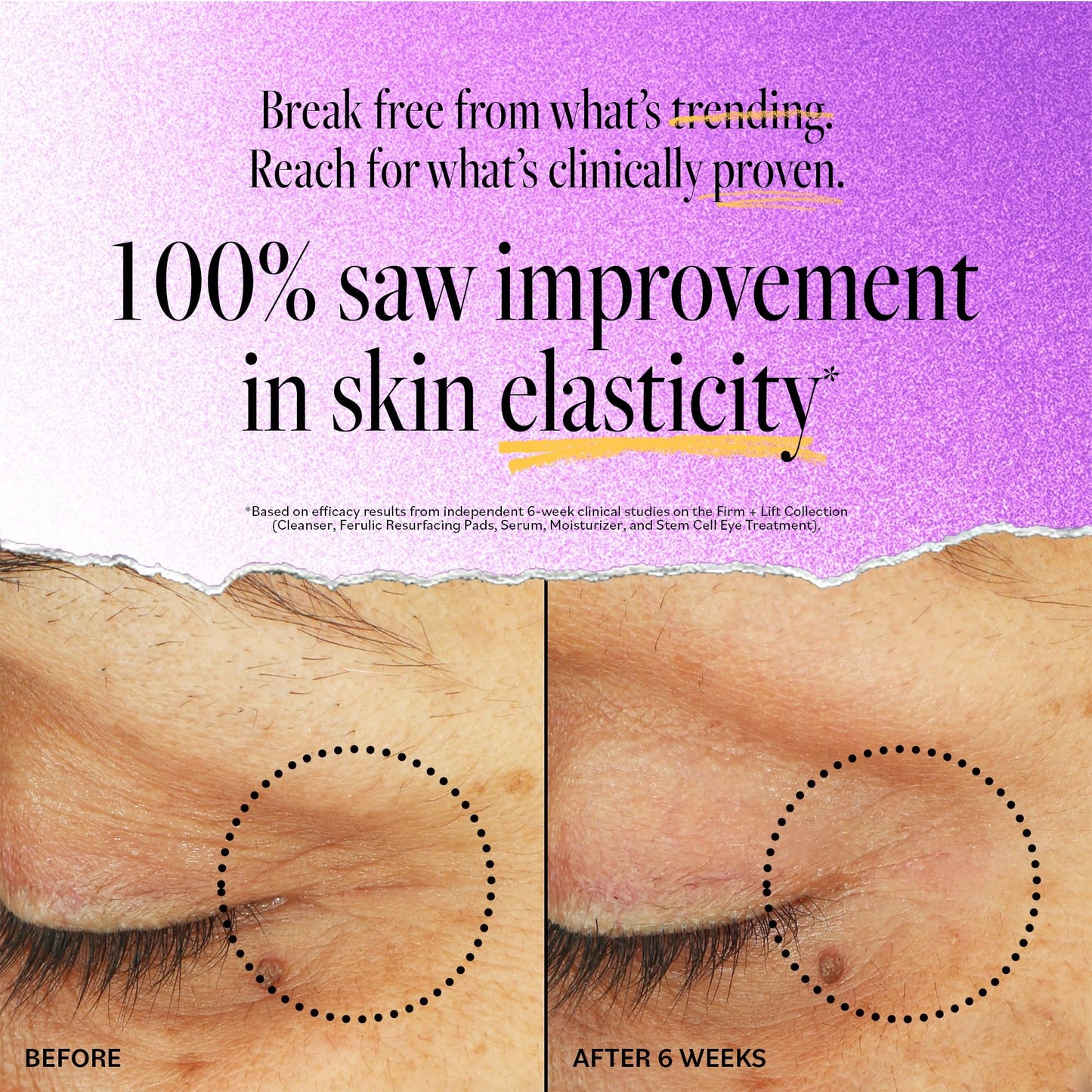 Derma E Stem Cell Lifting Eye Cream – Firming & Tightening for Under Eye & Upper Eyelid, Hydrating & Revitalizing, 0.5 oz