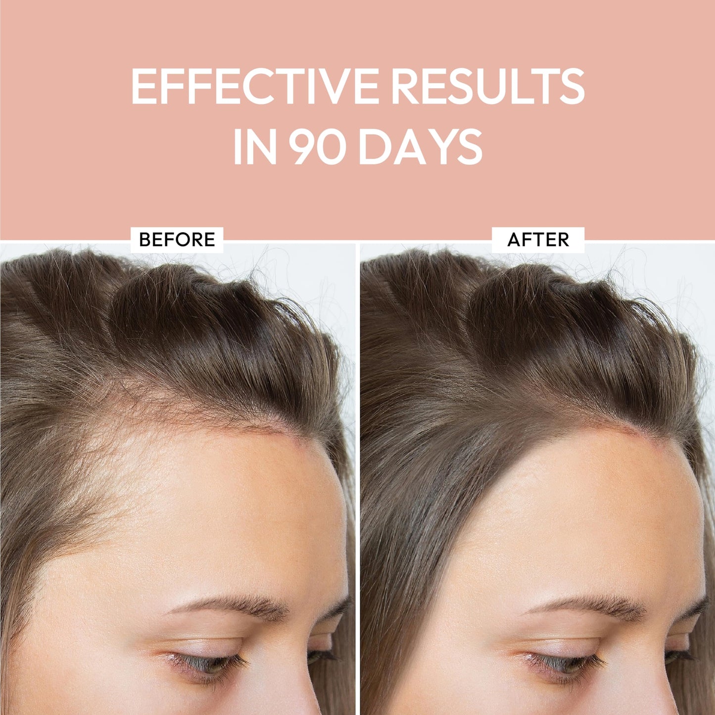 Luxe Cosmetics Hair Growth Serum 30ml – Advanced Formula for Women to Promote Thicker, Fuller & Shinier Hair – Nourishing Scalp Treatment for Dry Scalp