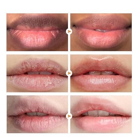 Lips Pink Fresh Lightening Repair Remove Dark Smoke Lips Lip Balm Improve dark lips Moisturizing Nourishing Lip Care