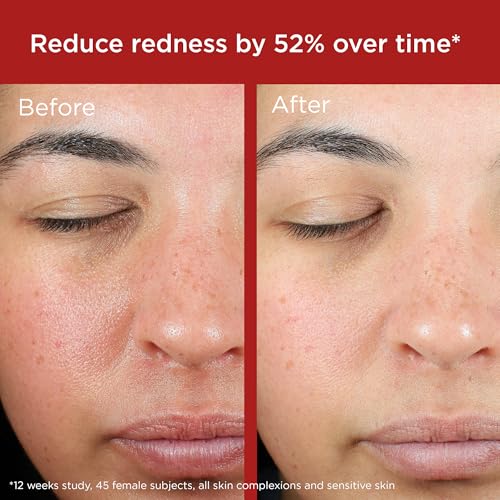 EltaMD UV Skin Recovery Green Tint All Mineral, Redness Reduction, Sensitive Skin Face Sunscreen SPF 50